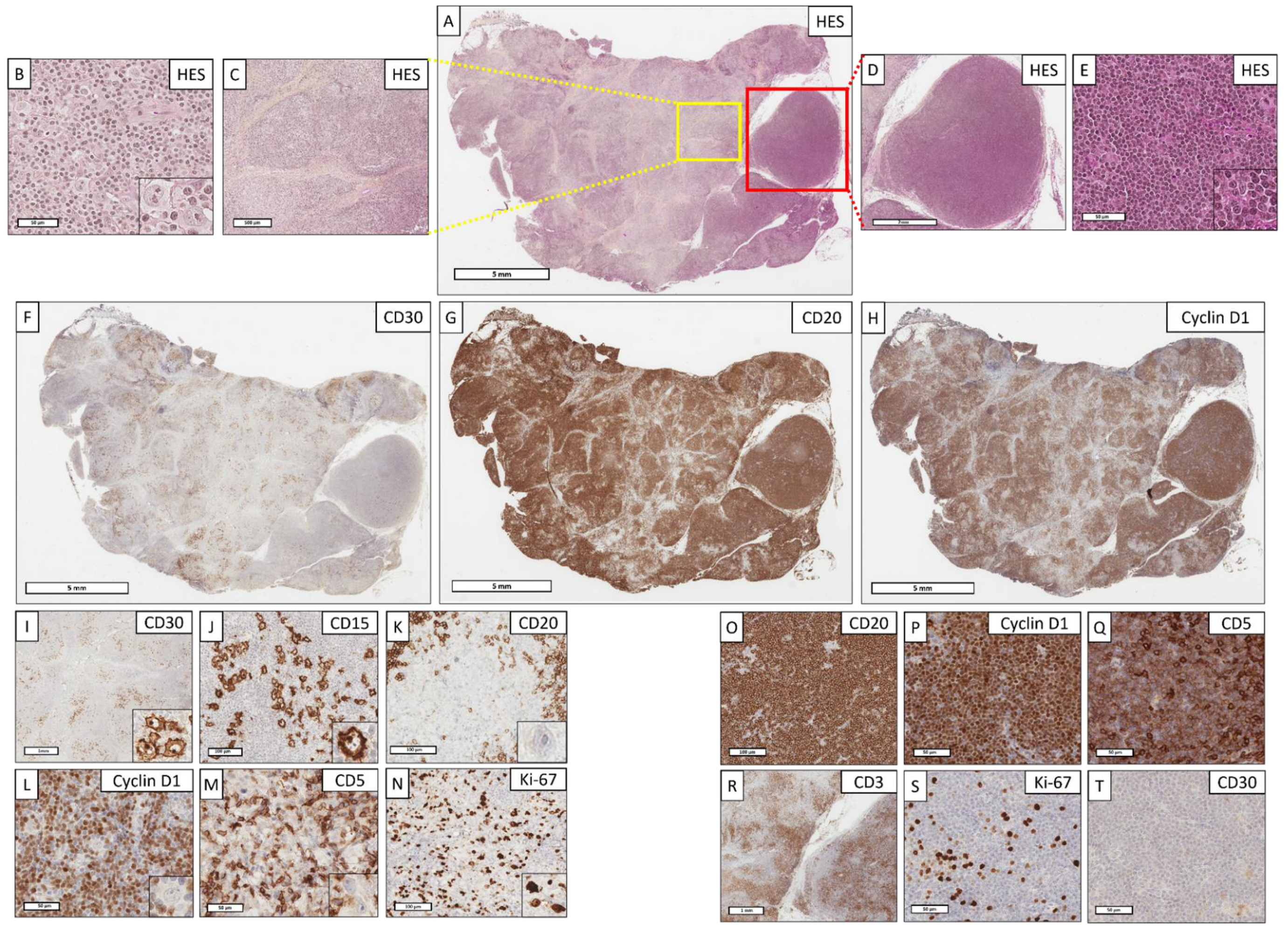 Cancers 14 05695 g002