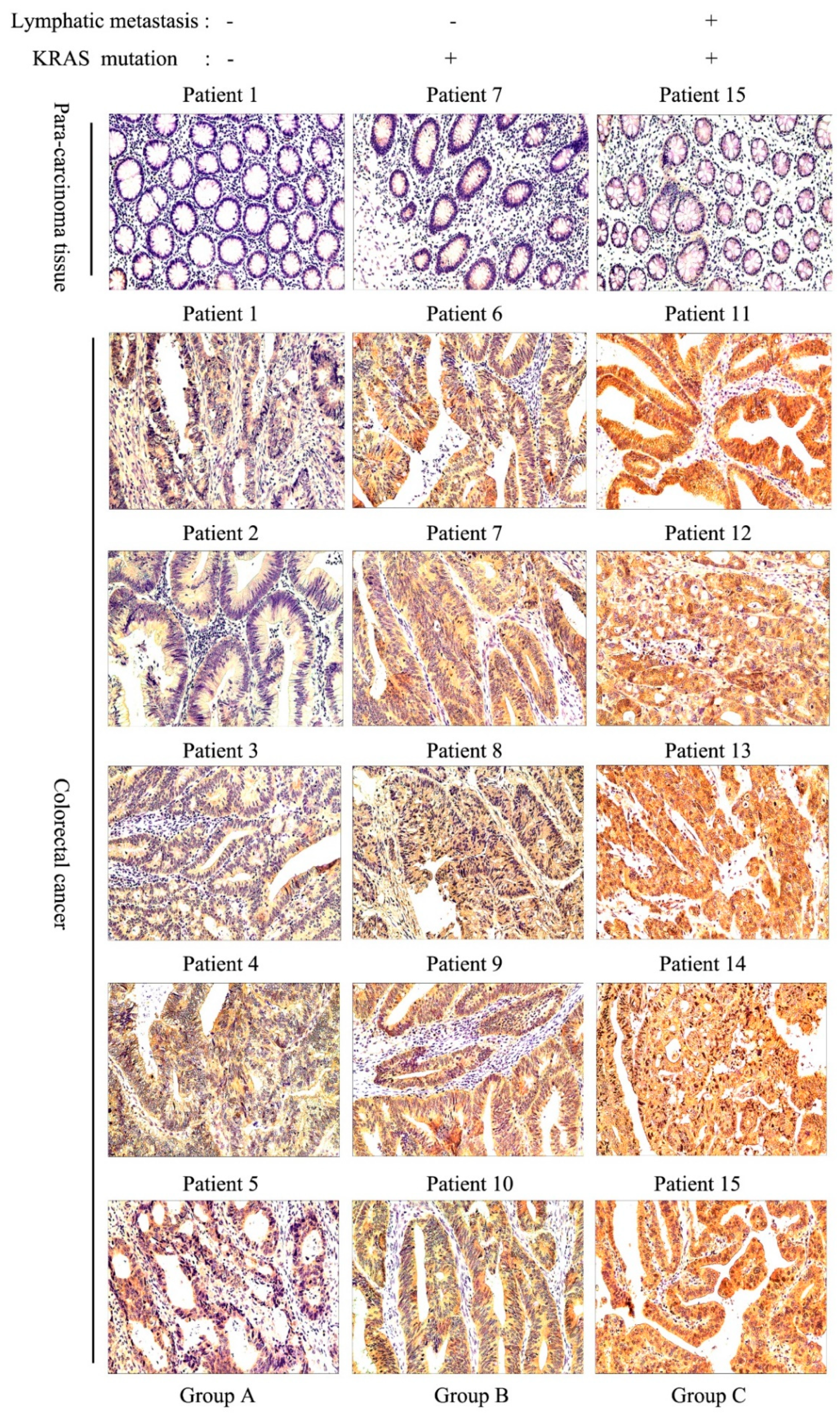 Cancers 14 05704 g003 Cancers 14 05704 g003