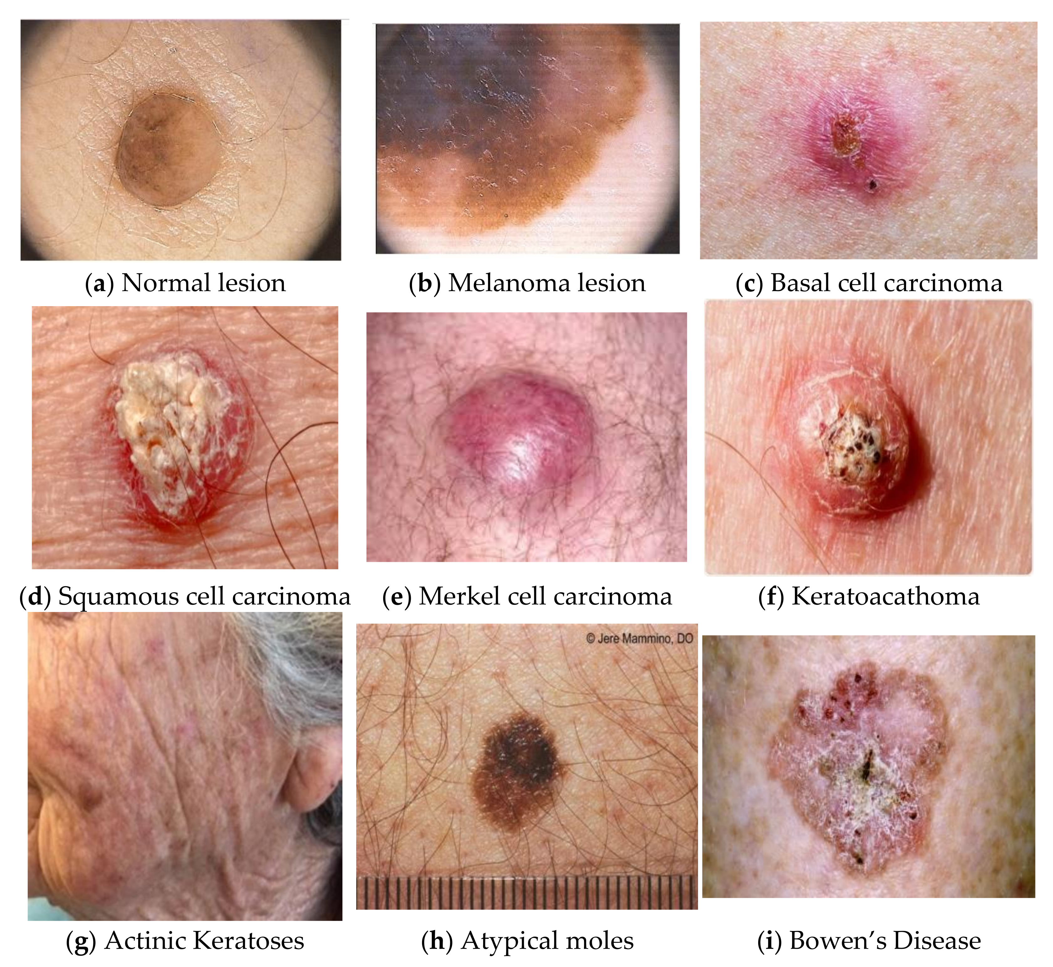 Cancers 14 05716 g001