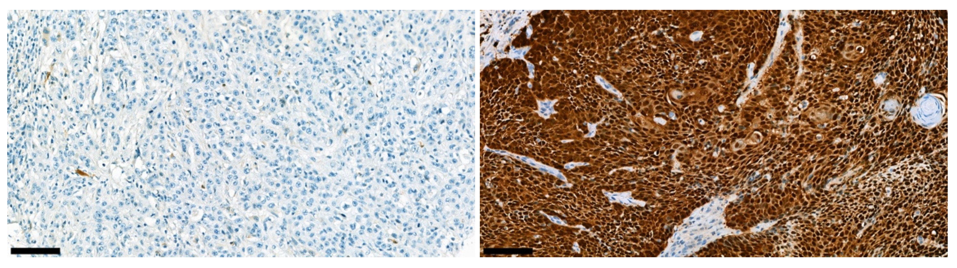 Cancers 14 05717 g006