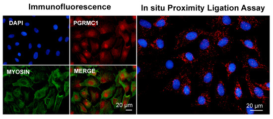 Cancers 14 05755 g002