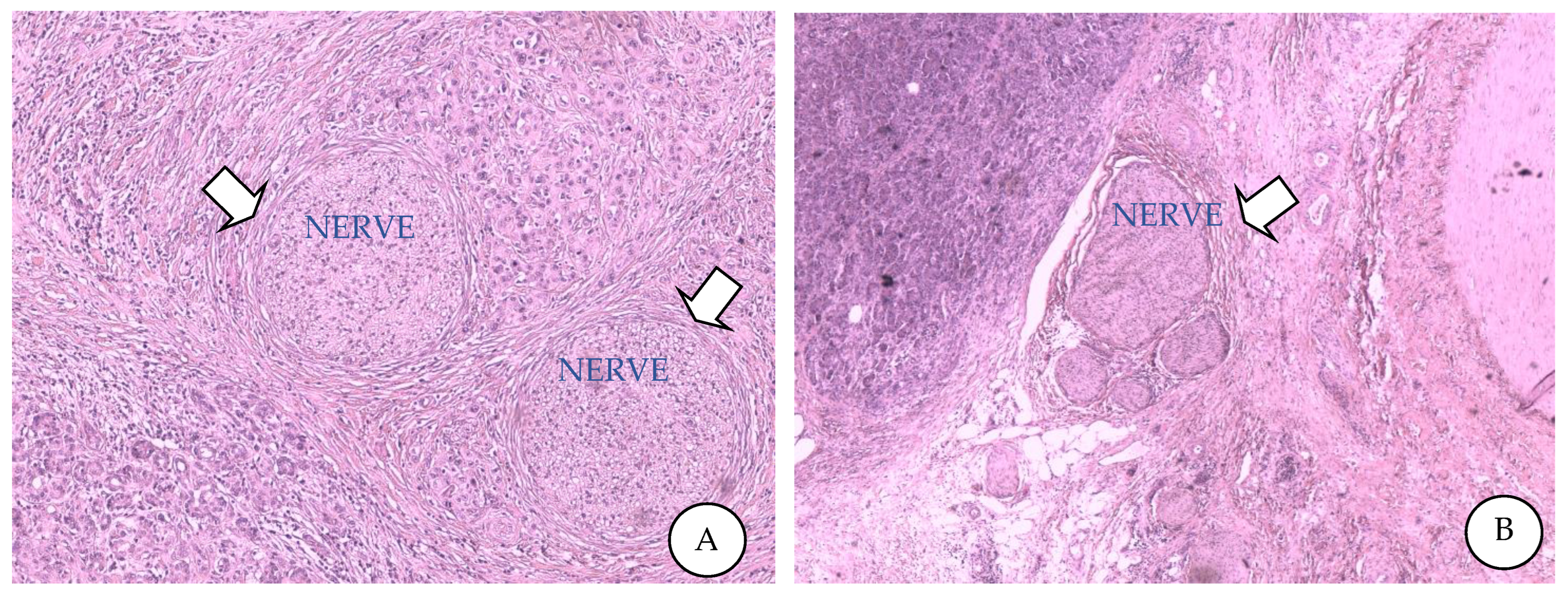 Cancers 14 05793 g001