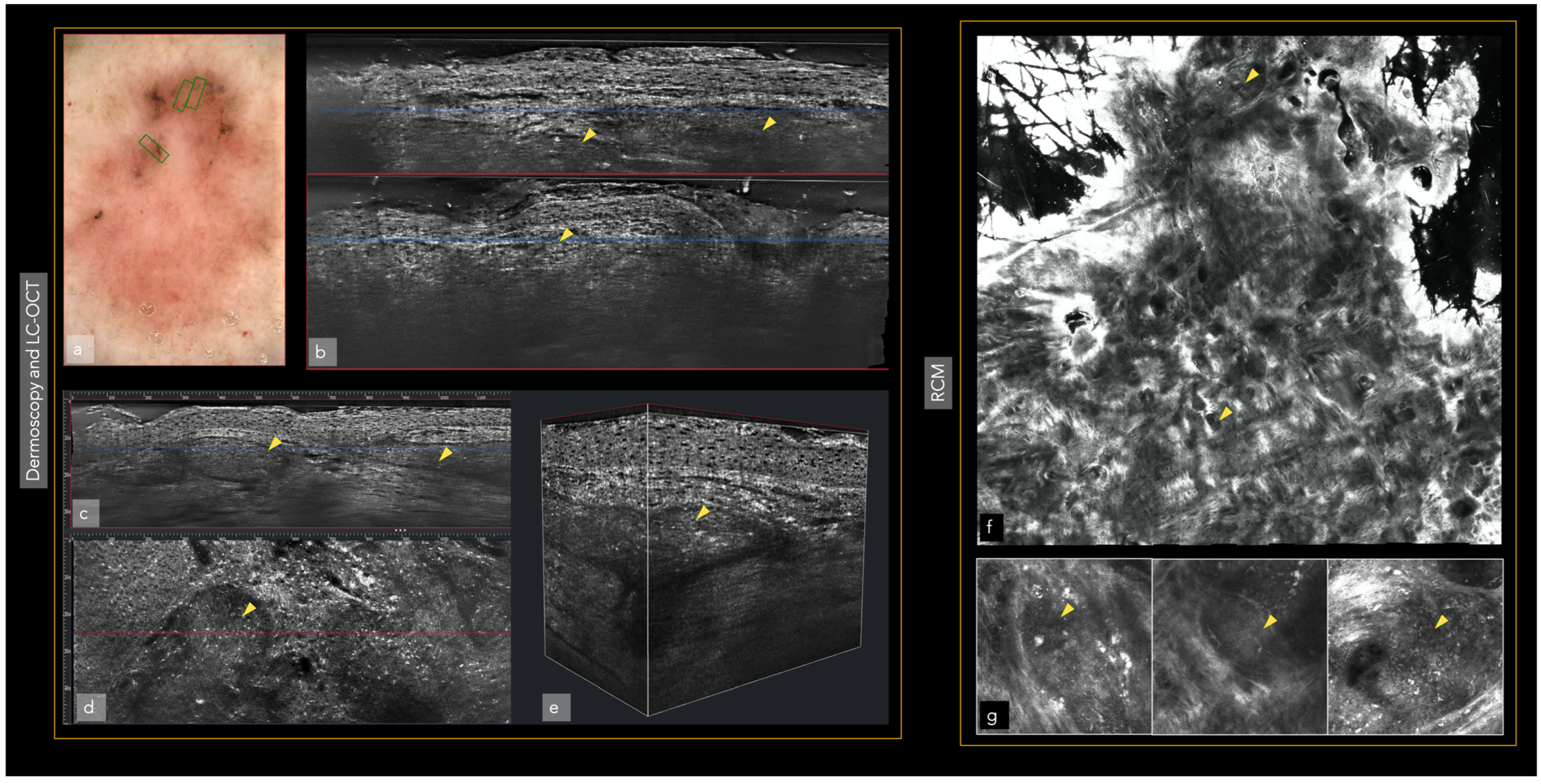 Cancers 14 05886 g002 Cancers 14 05886 g002