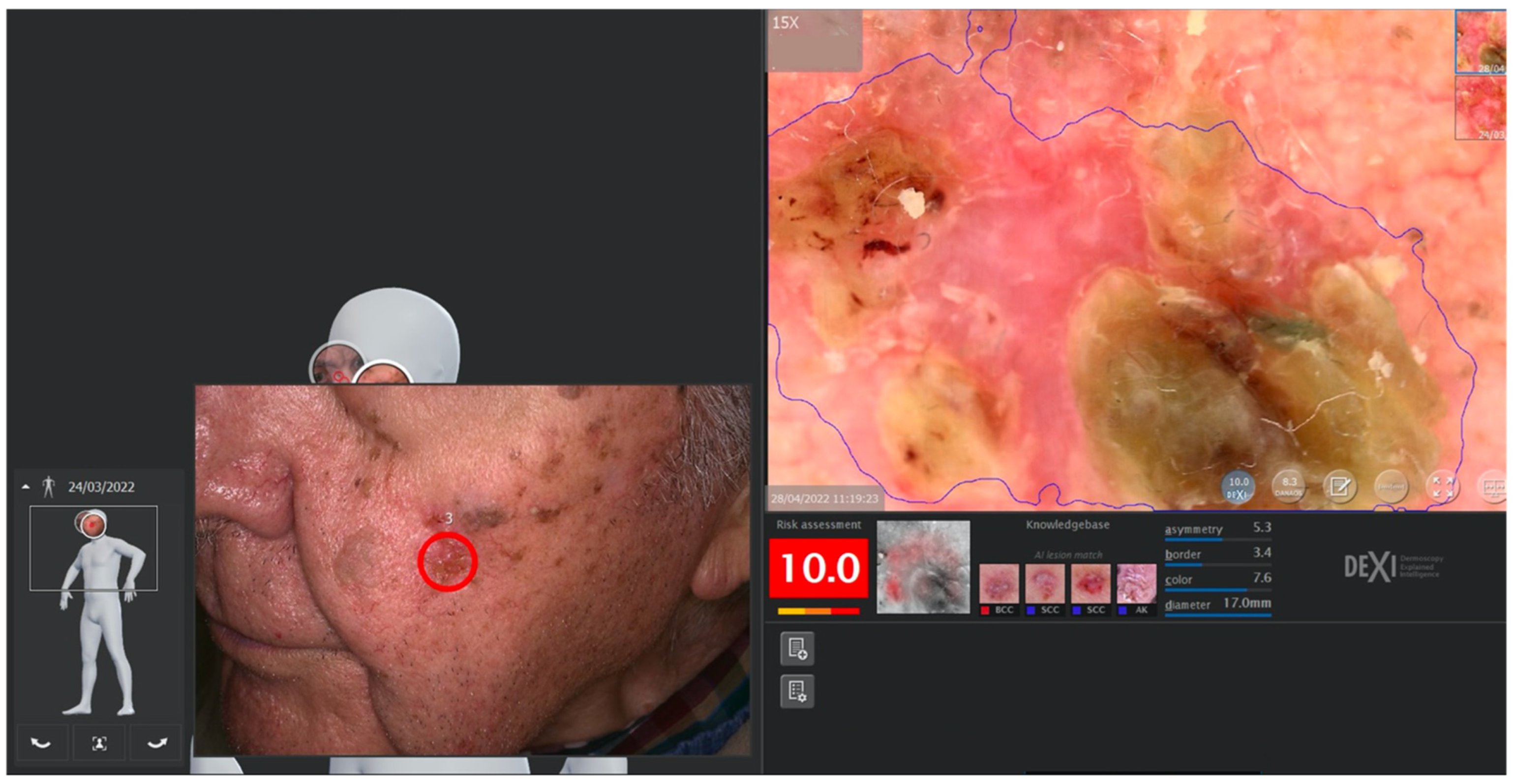 Cancers 14 05886 g004 Cancers 14 05886 g004