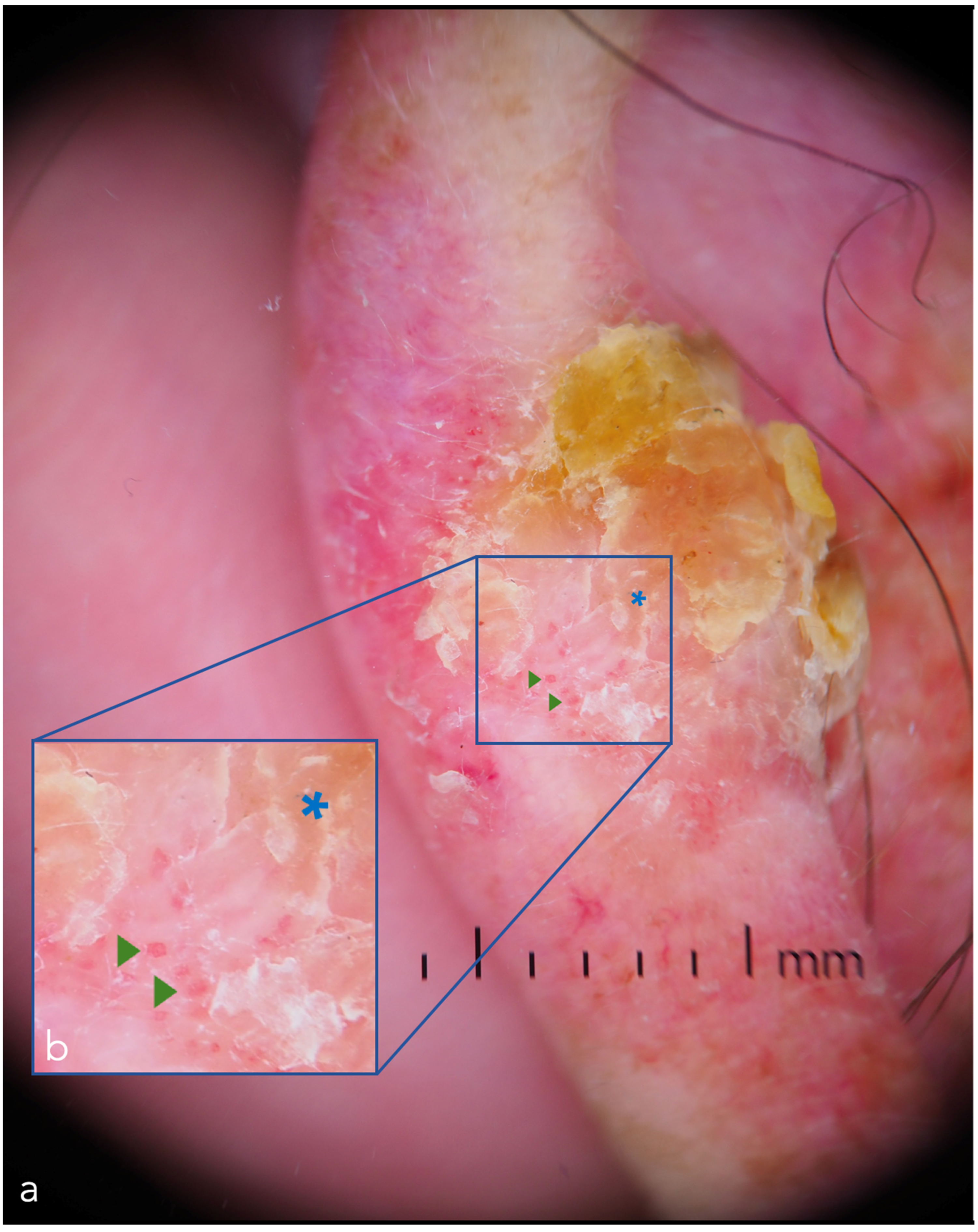 Cancers 14 05886 g005 Cancers 14 05886 g005