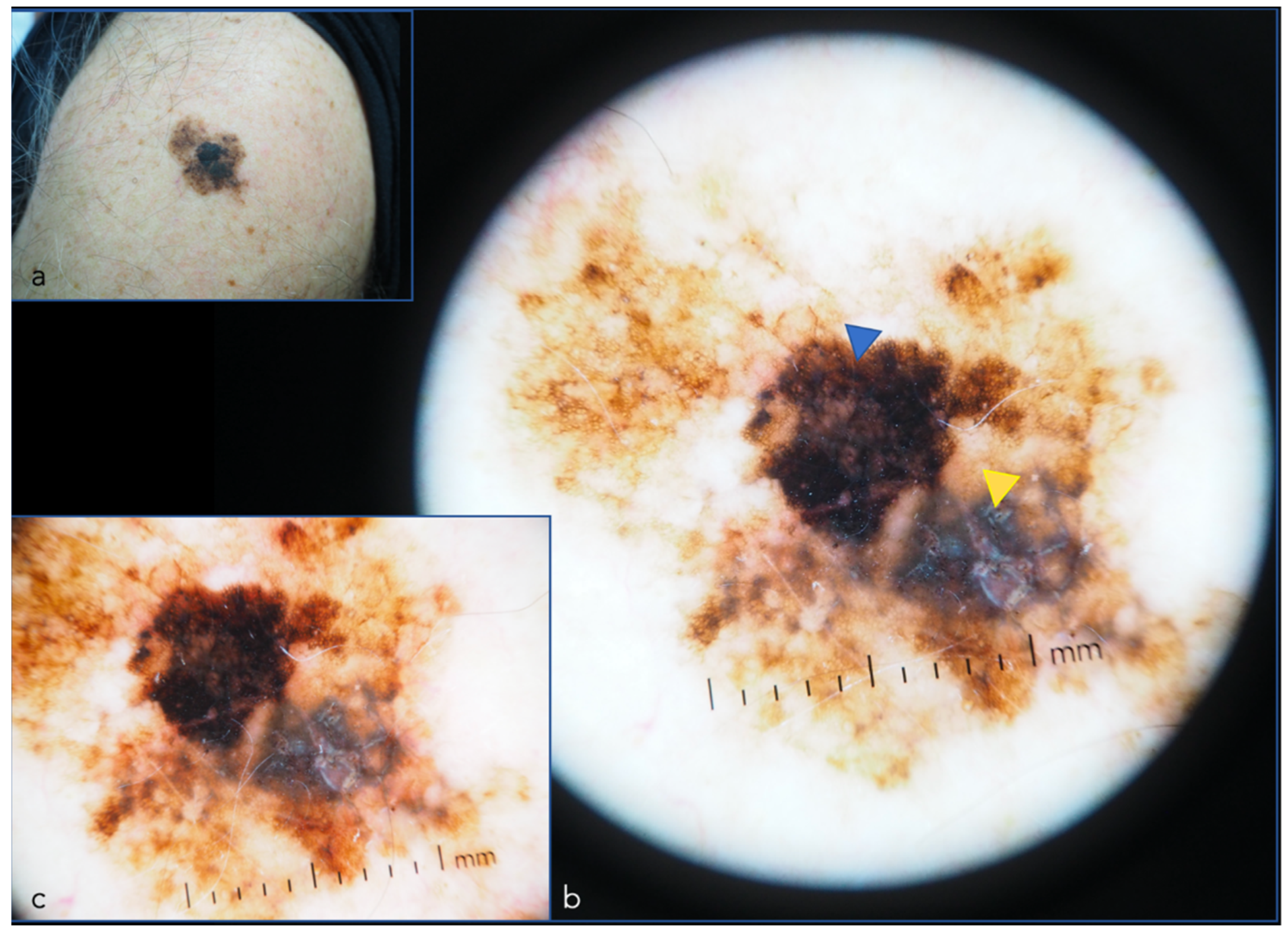 Cancers 14 05886 g006 Cancers 14 05886 g006