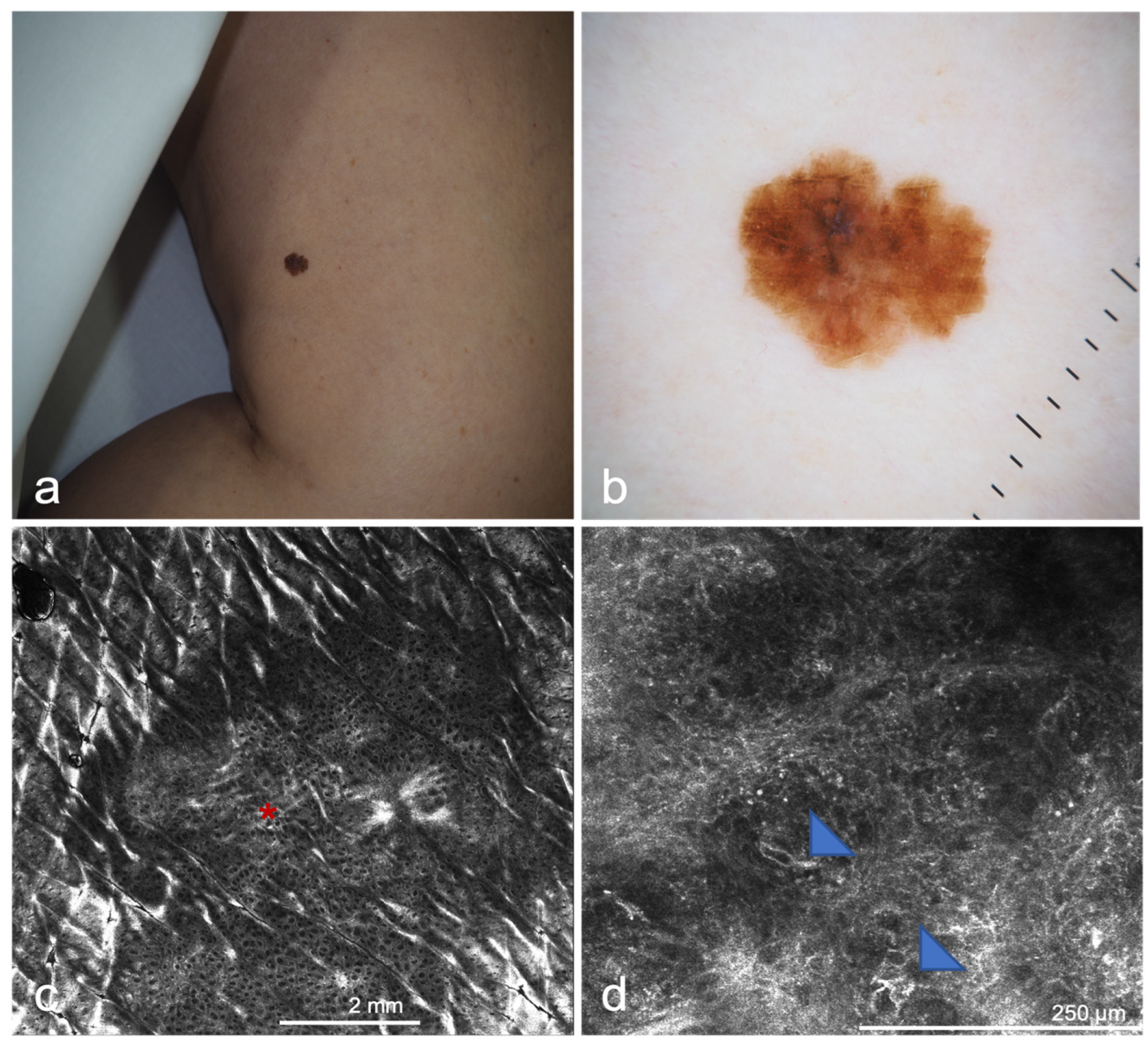 Cancers 14 05886 g007 Cancers 14 05886 g007