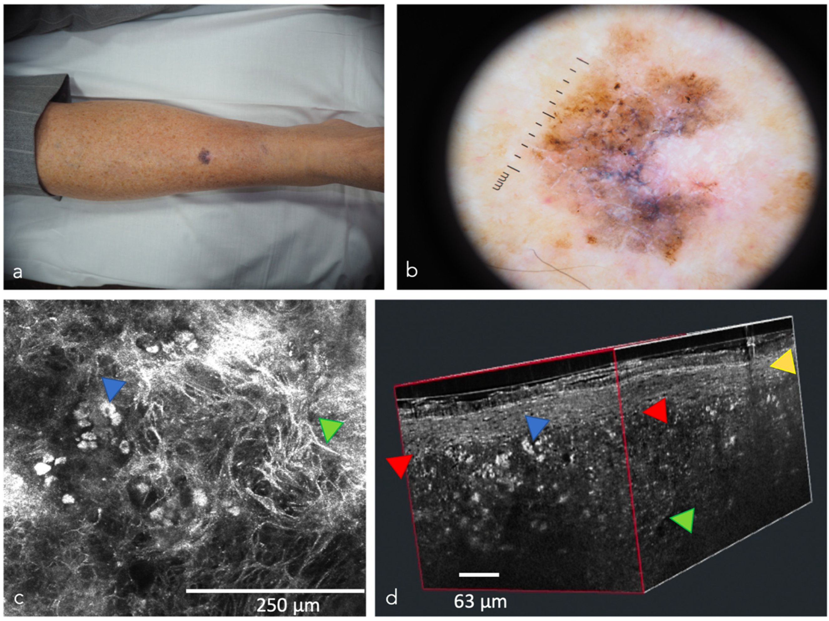 Cancers 14 05886 g008 Cancers 14 05886 g008