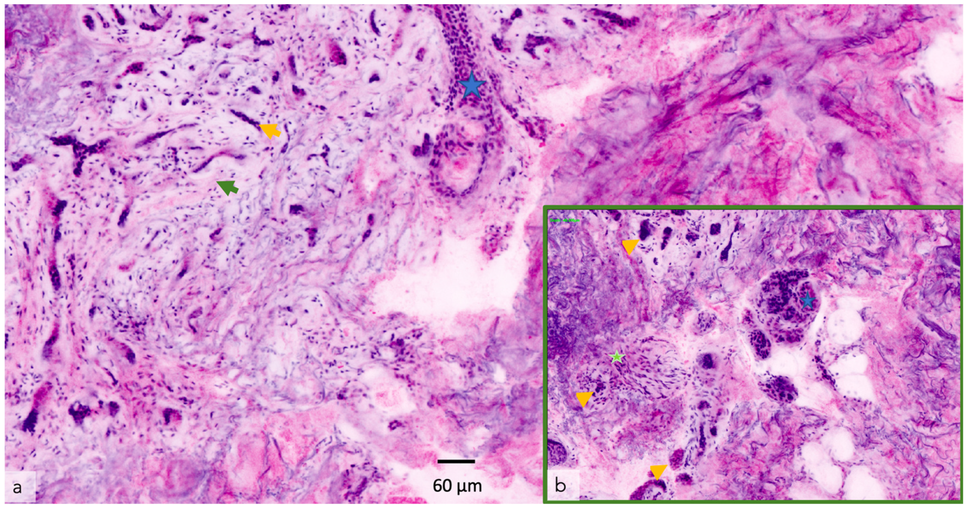 Cancers 14 05886 g009 Cancers 14 05886 g009
