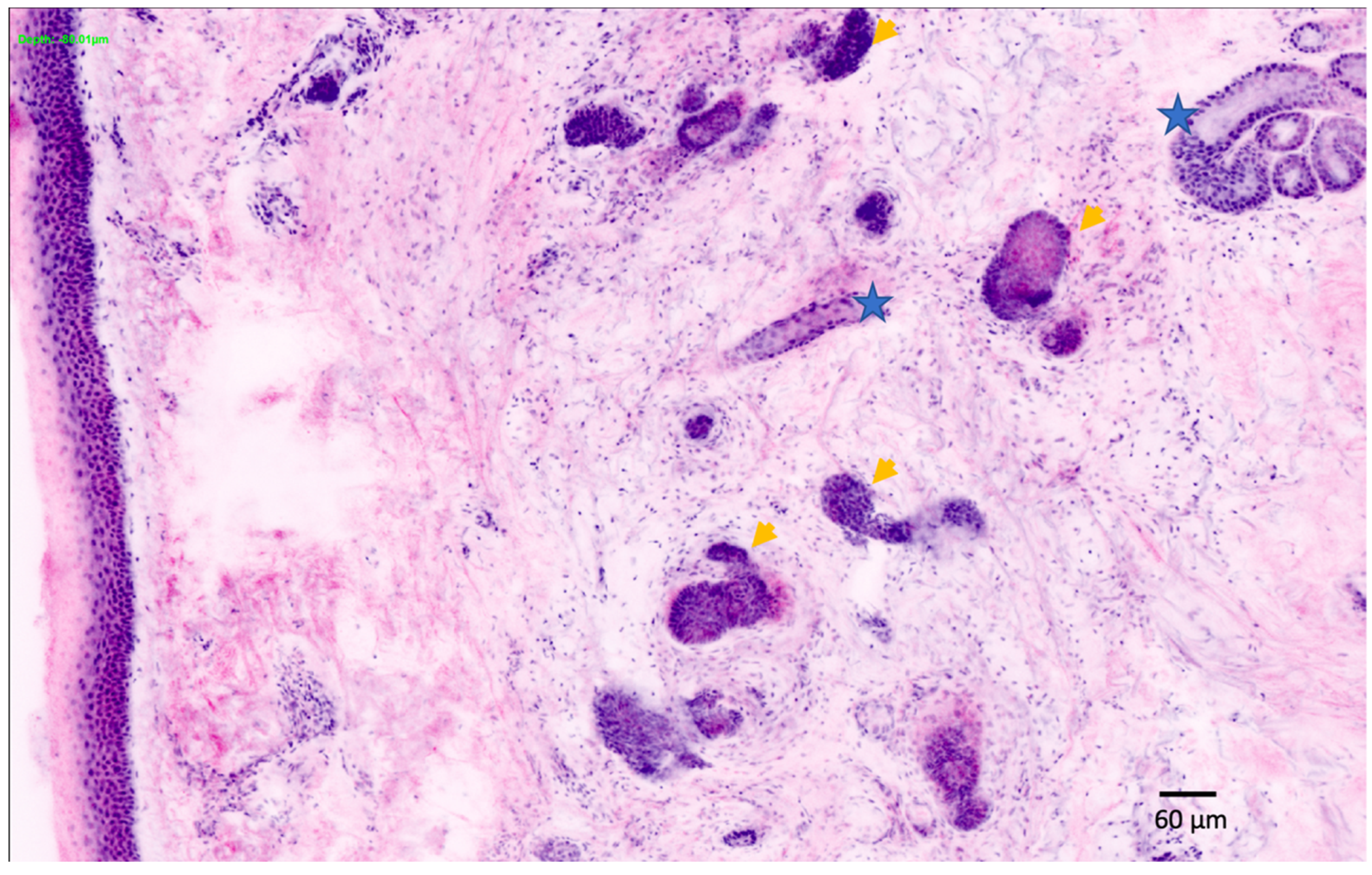 Cancers 14 05886 g010 Cancers 14 05886 g010