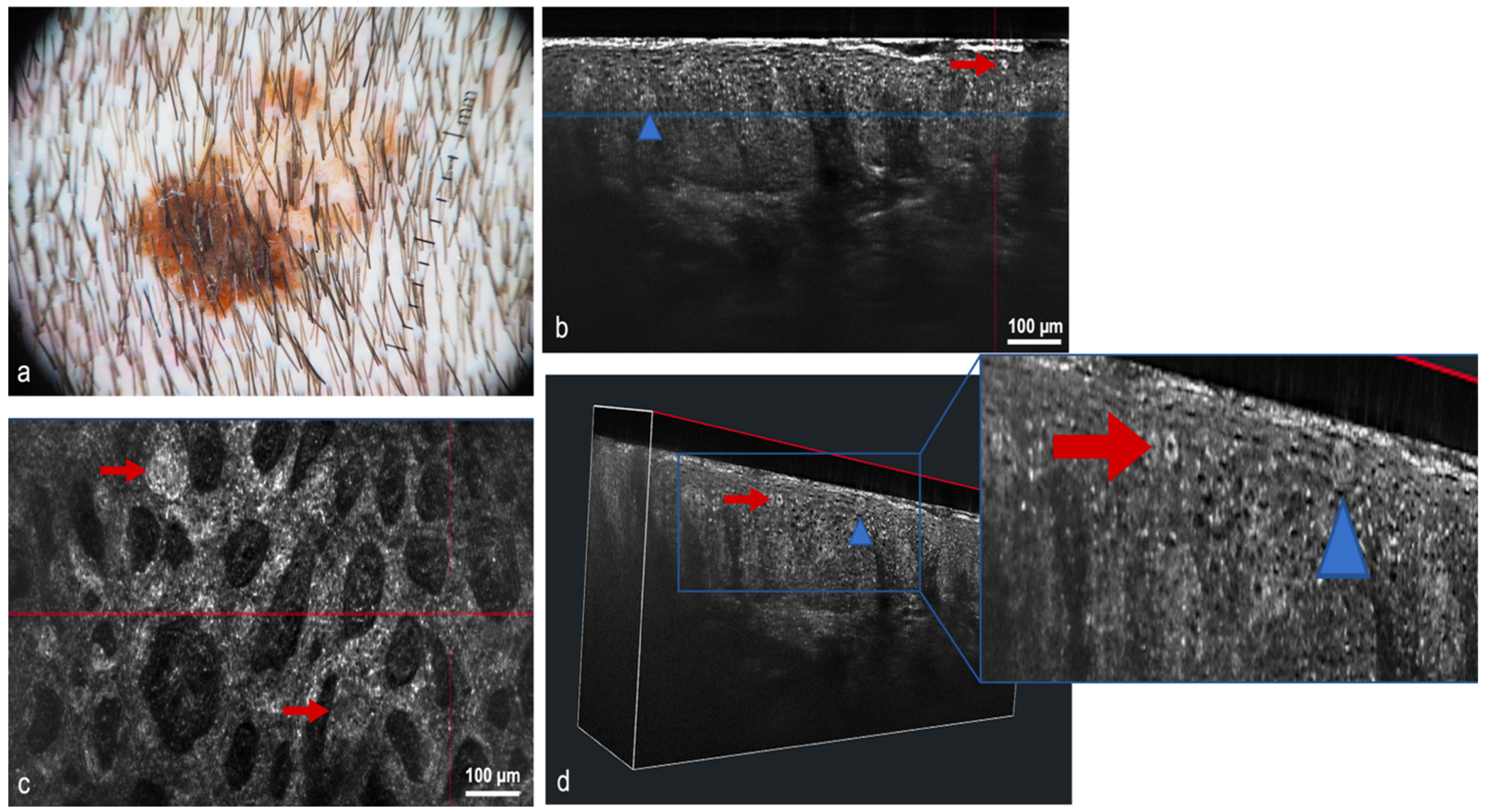 Cancers 14 05886 g011 Cancers 14 05886 g011