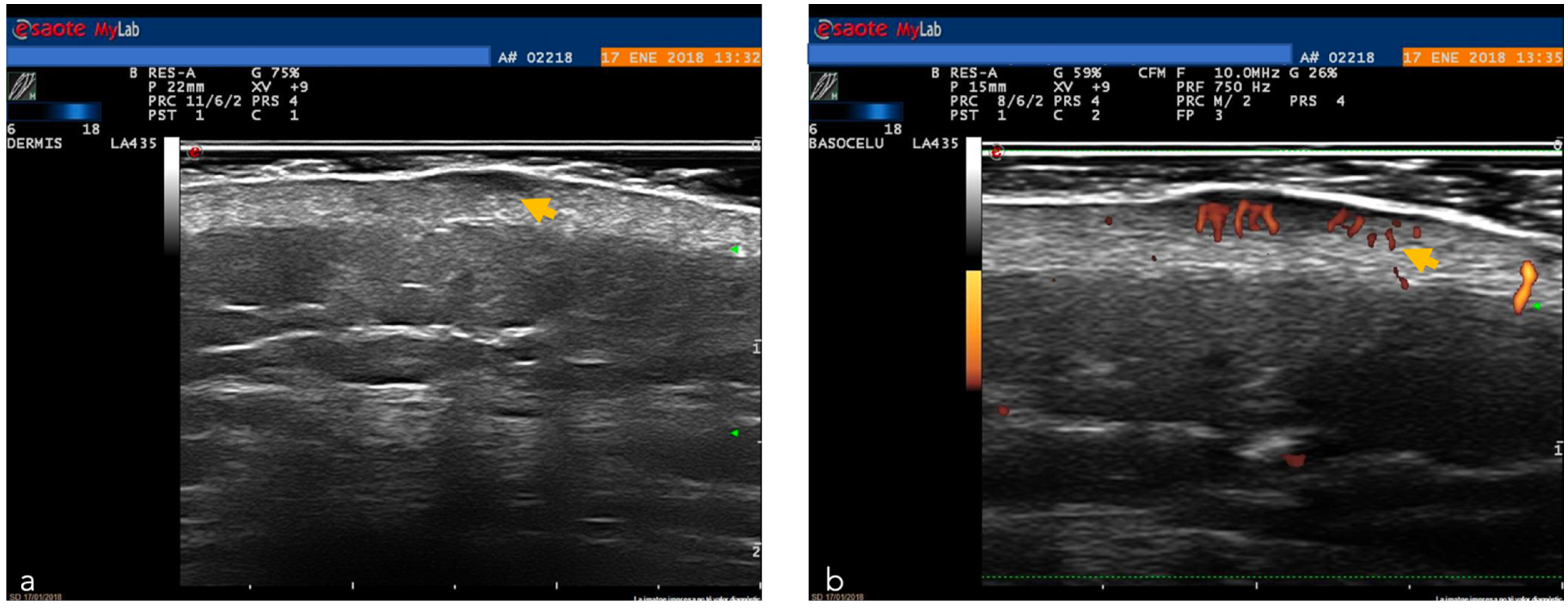 Cancers 14 05886 g012 Cancers 14 05886 g012