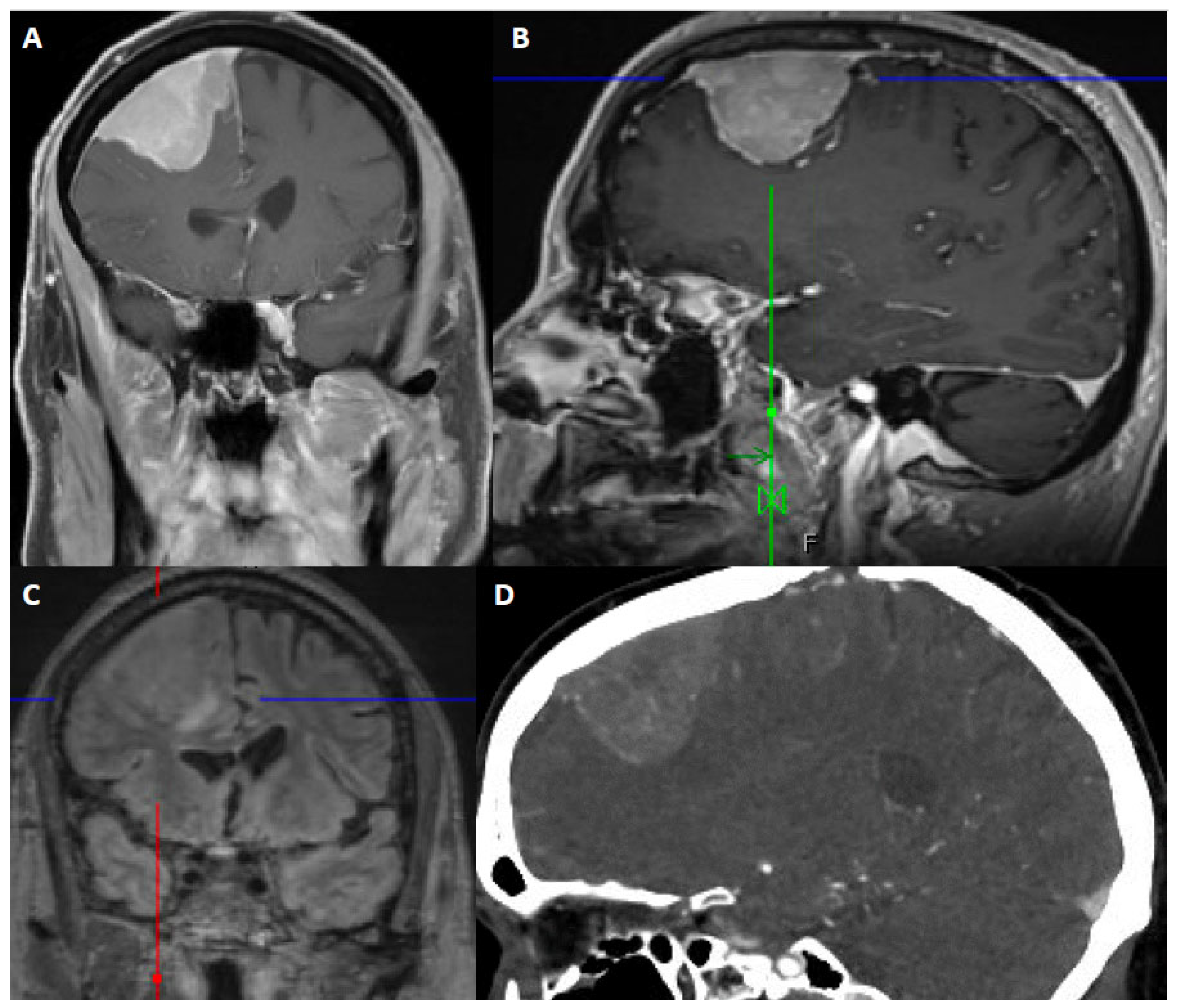 Cancers 14 05887 g002