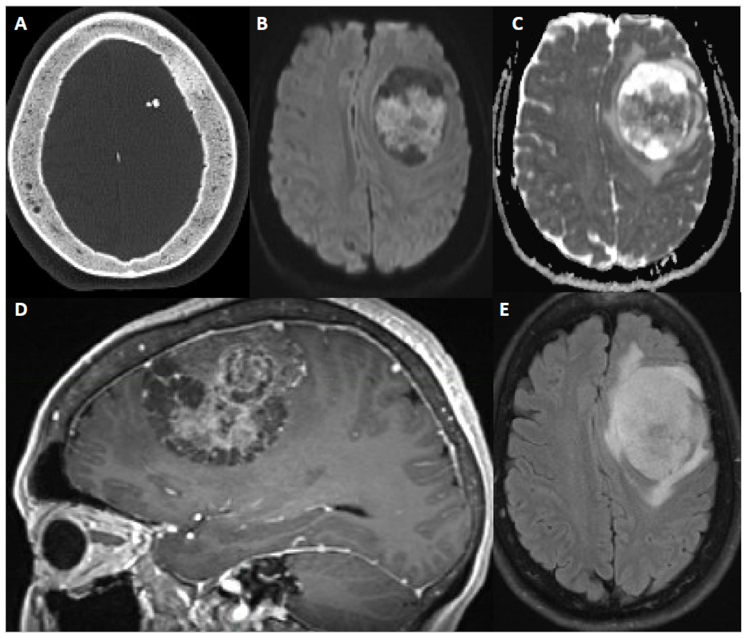 Cancers 14 05887 g003