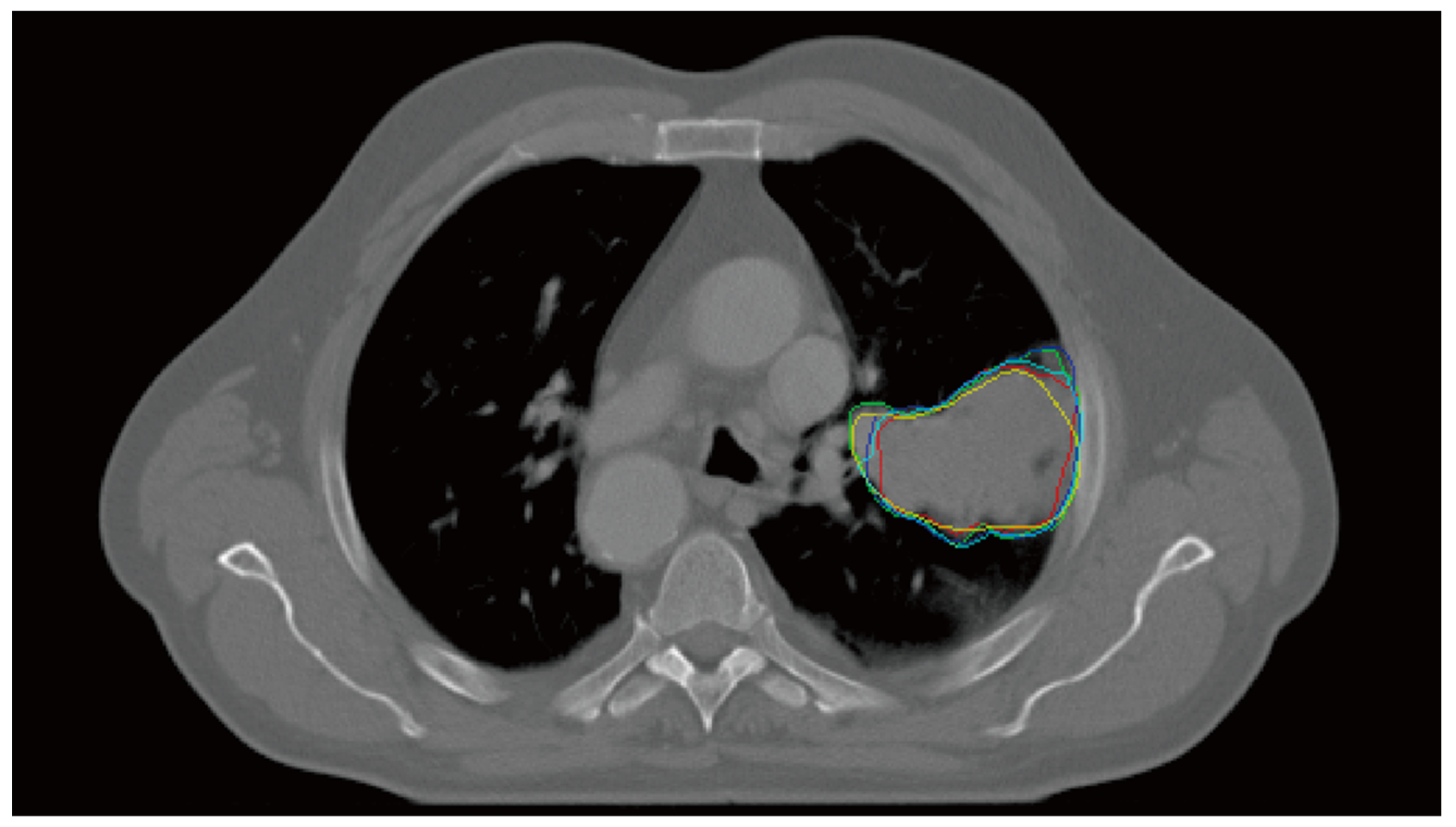 Cancers 14 05893 g001