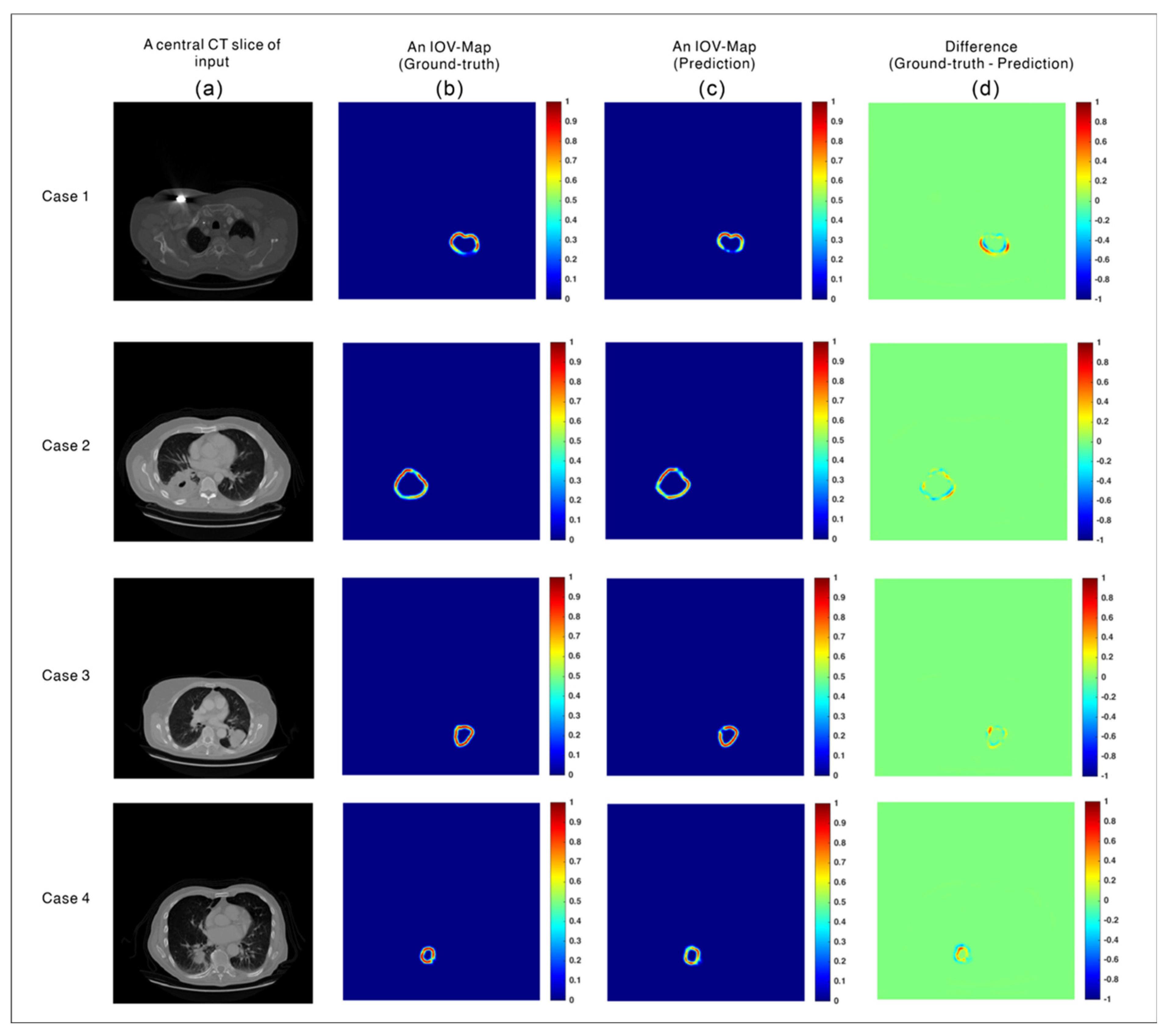 Cancers 14 05893 g004