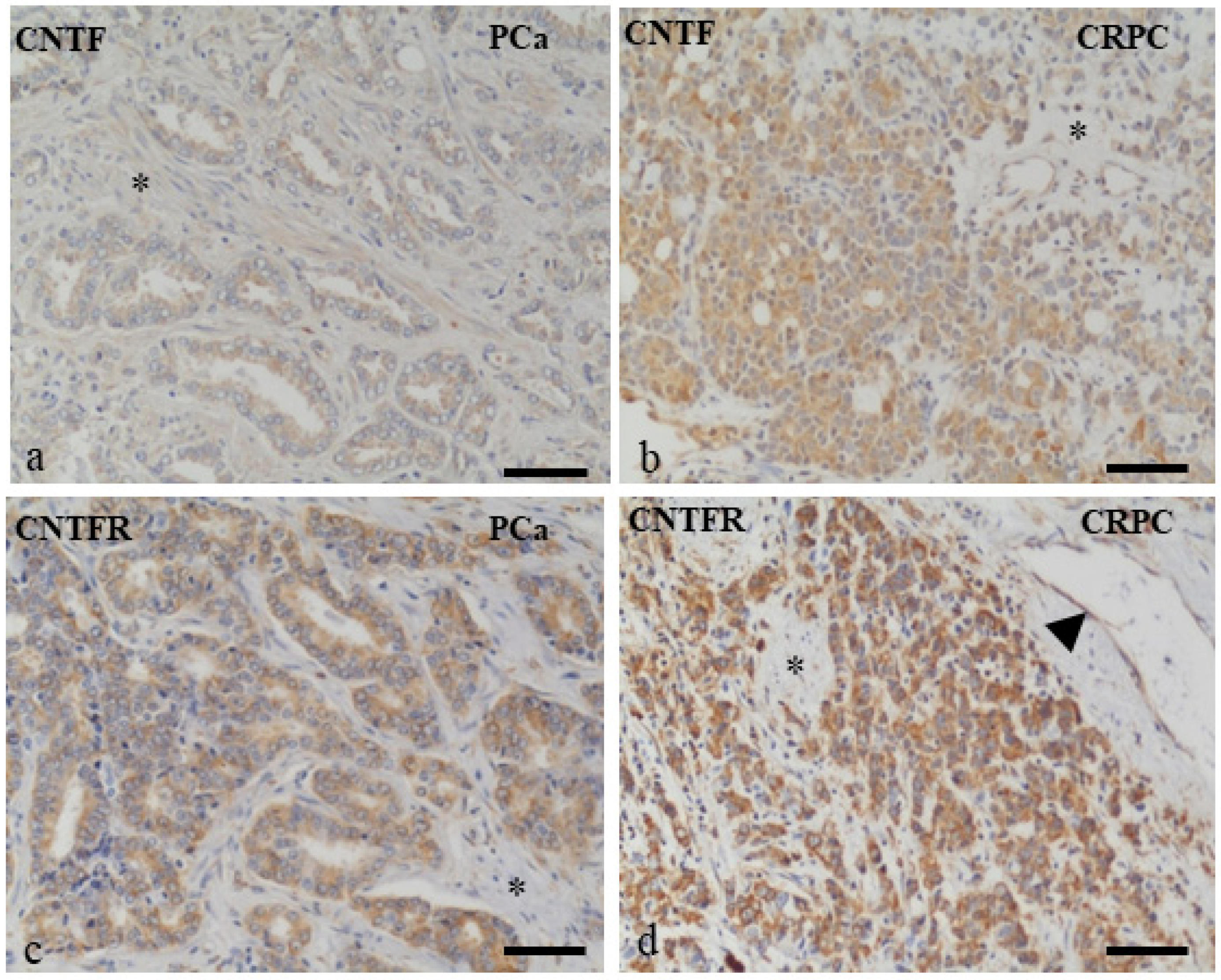 Cancers 14 05917 g001