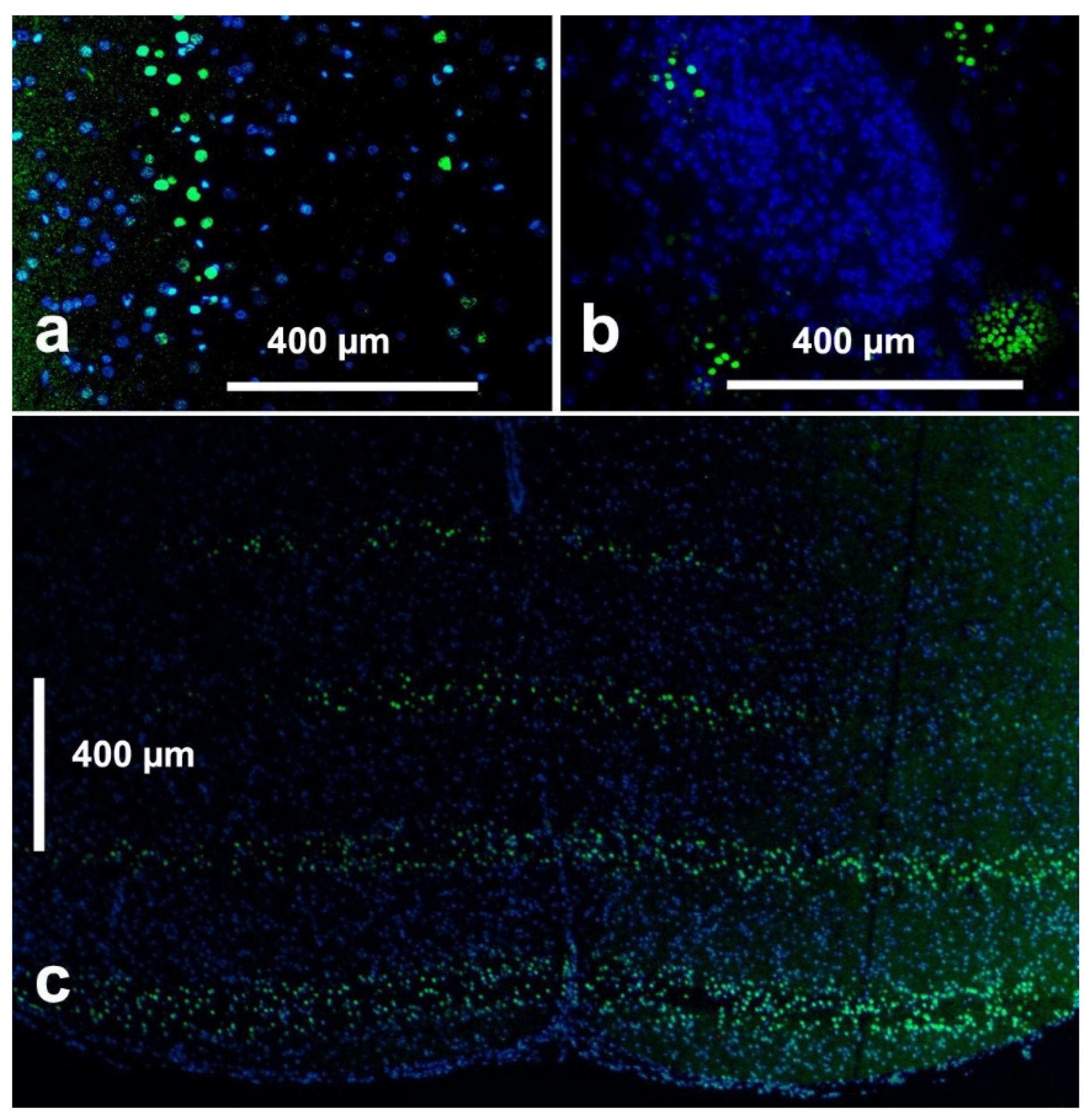 Cancers 14 05964 g003