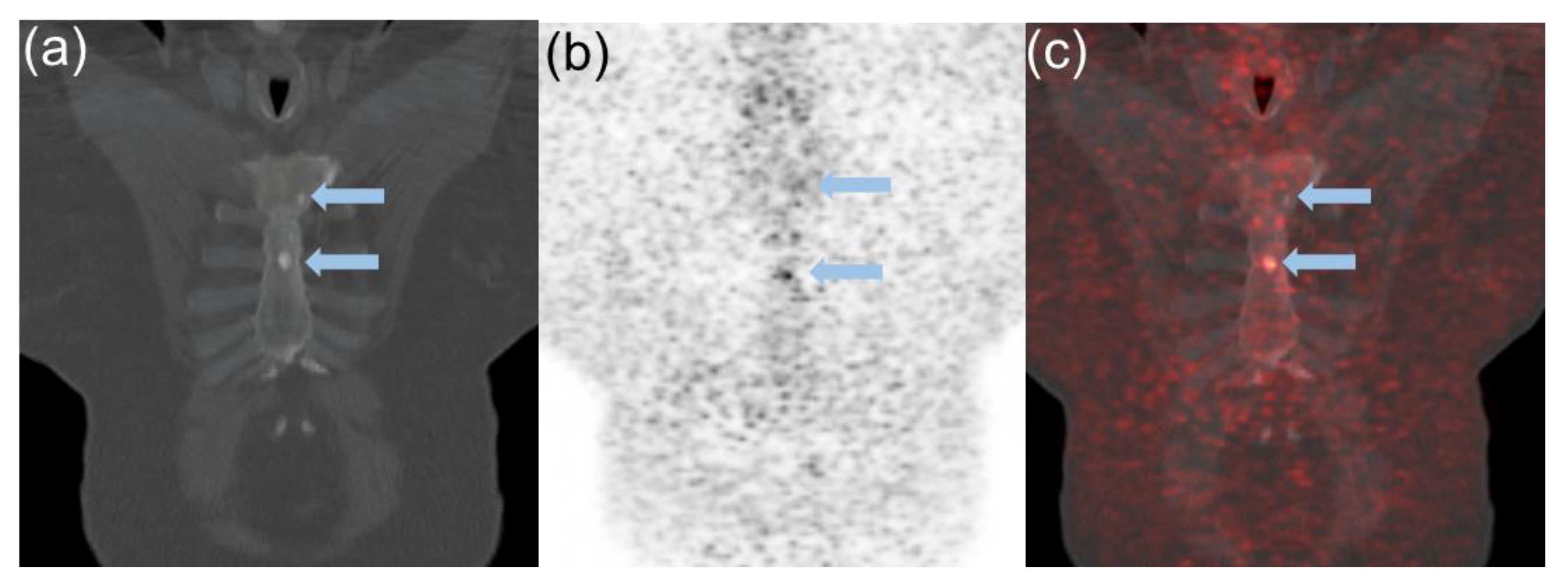 Cancers 14 06039 g001