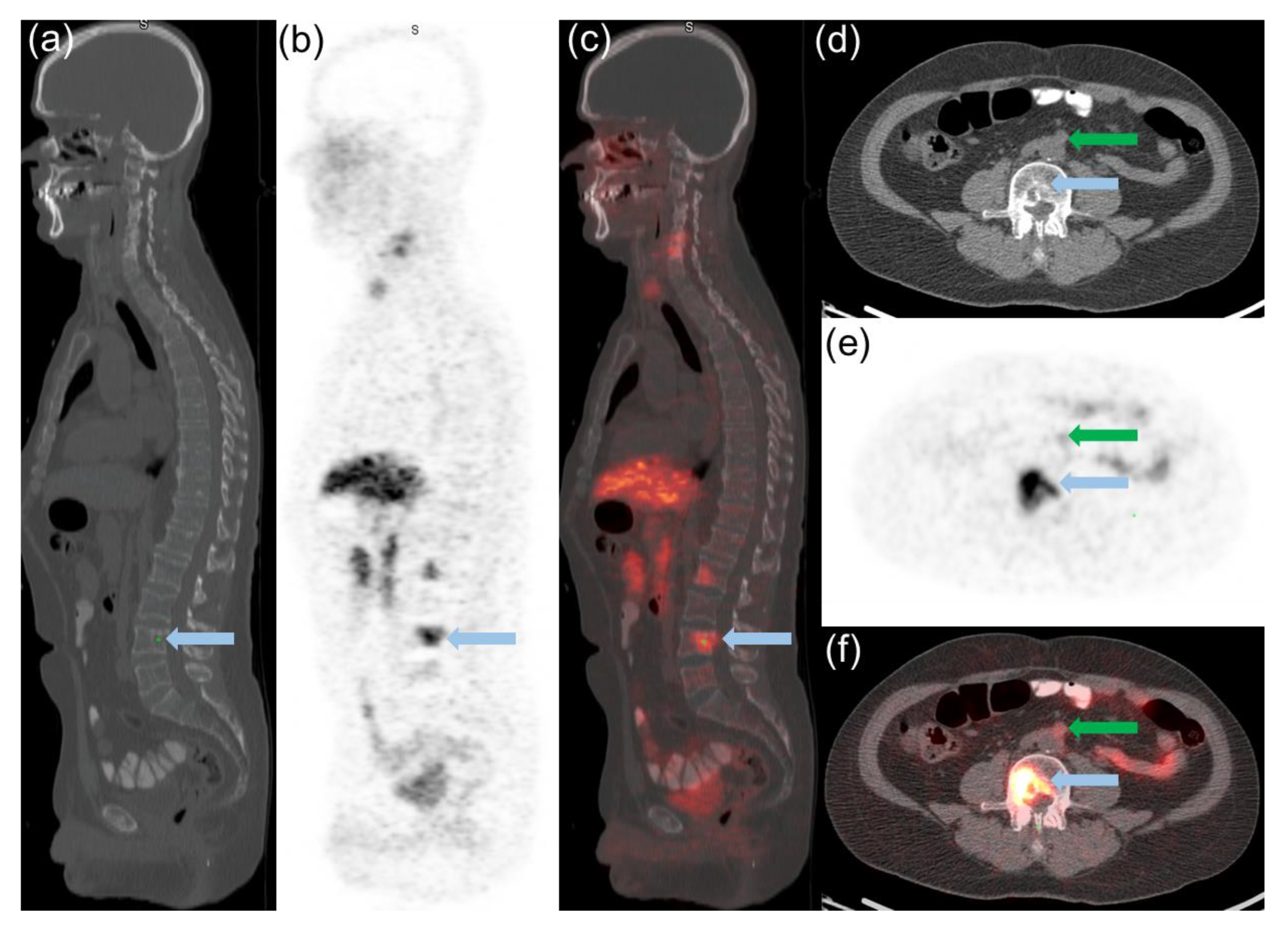 Cancers 14 06039 g002
