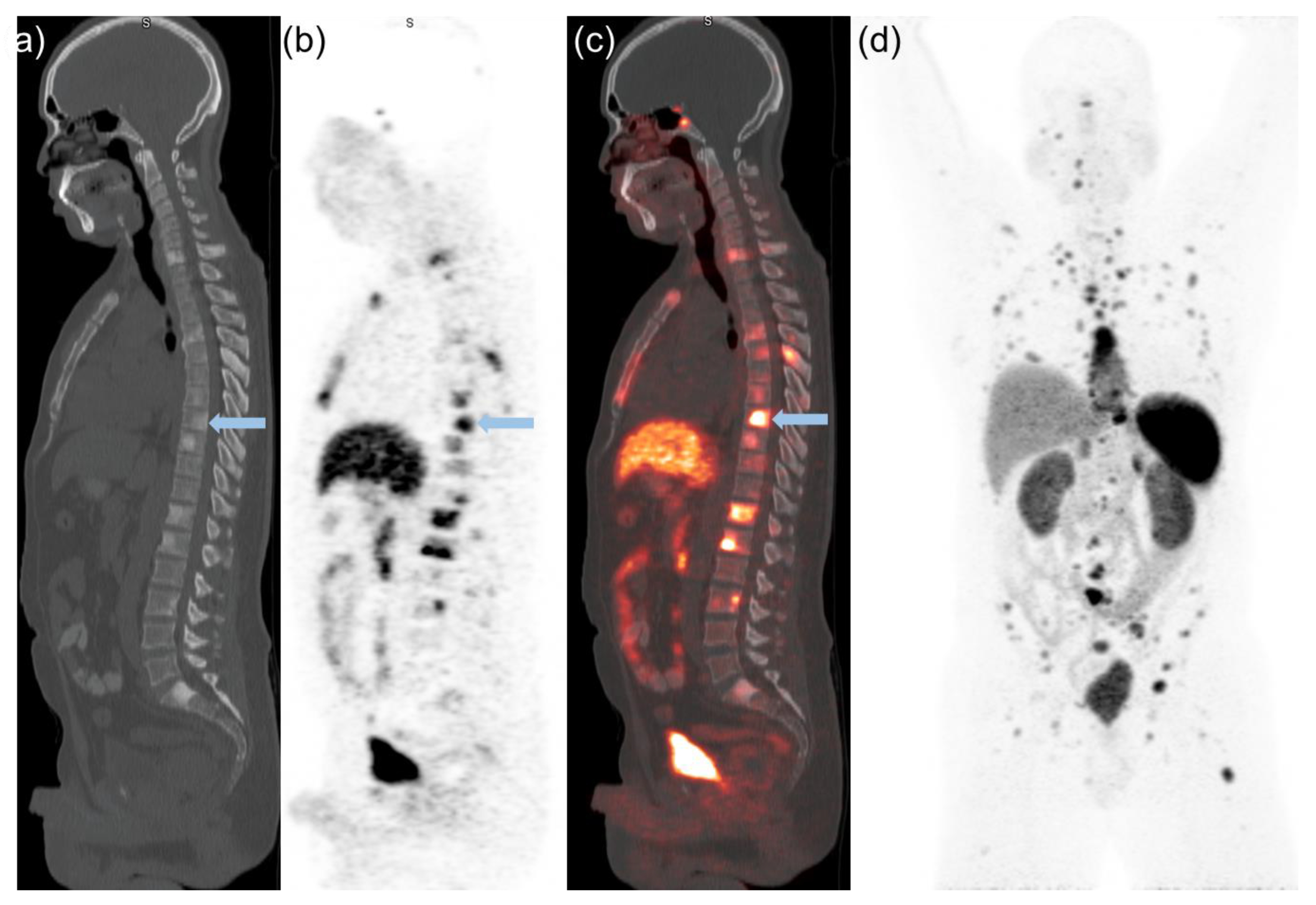 Cancers 14 06039 g003