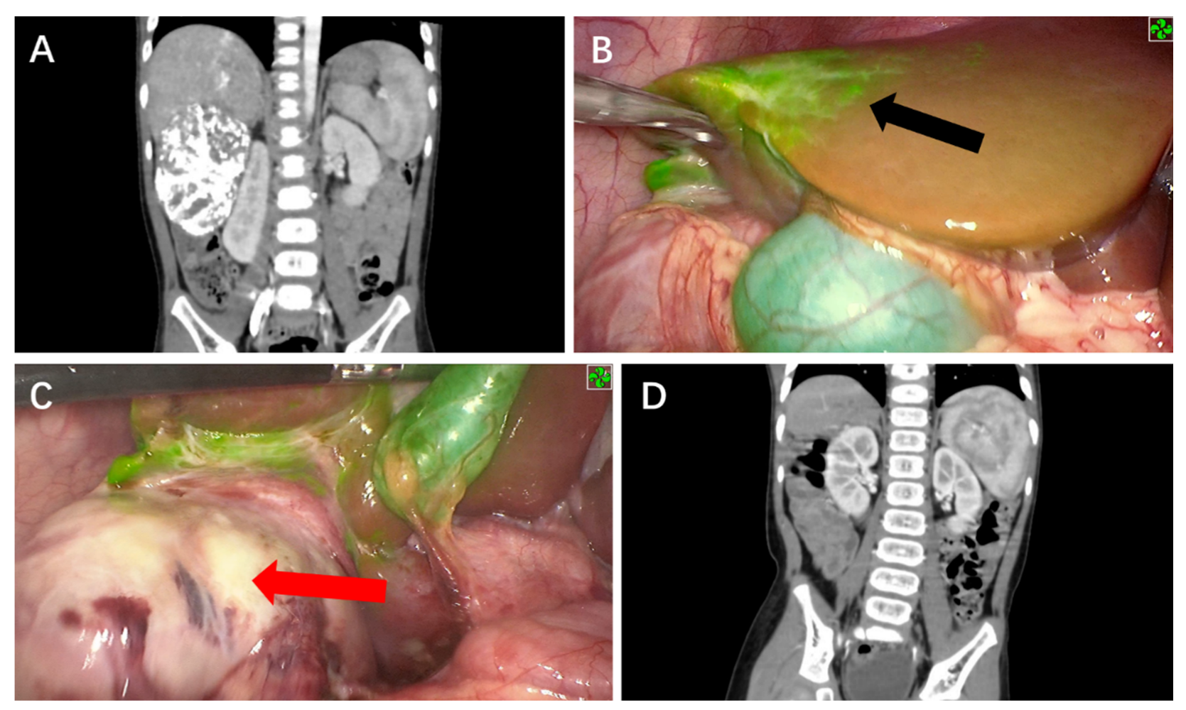 Cancers 14 06057 g003 Cancers 14 06057 g003