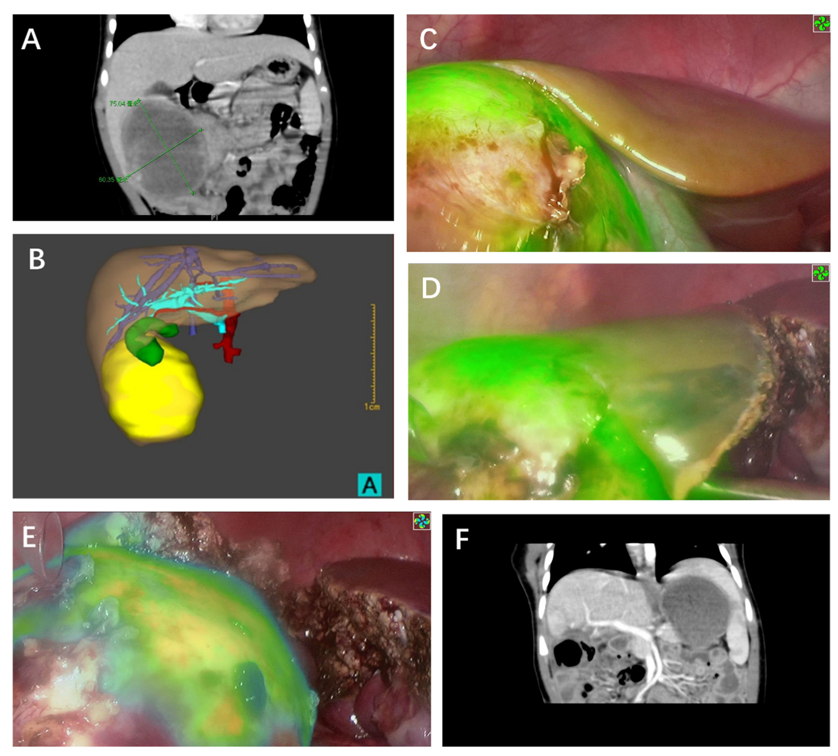 Cancers 14 06057 g005 Cancers 14 06057 g005