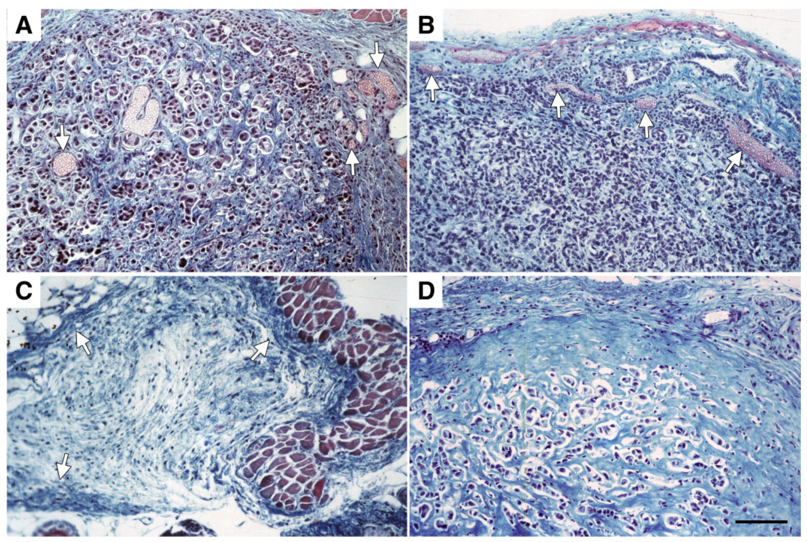 Cancers 14 06175 g003 Cancers 14 06175 g003