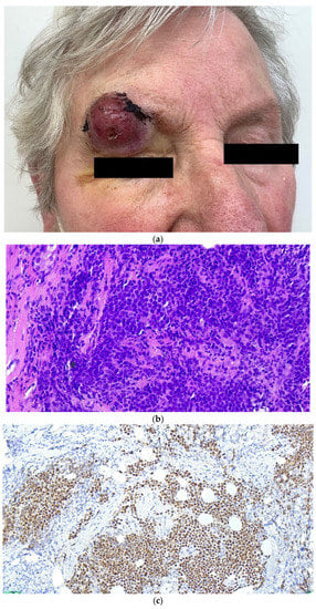 Cancers 14 06176 g003