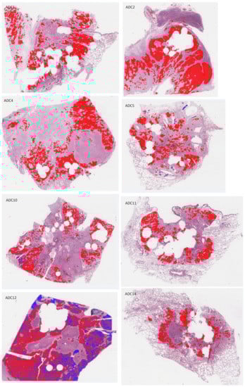 Cancers 14 06181 g0a4a Cancers 14 06181 g0a4a