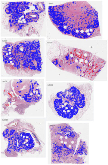 Cancers 14 06181 g0a4b