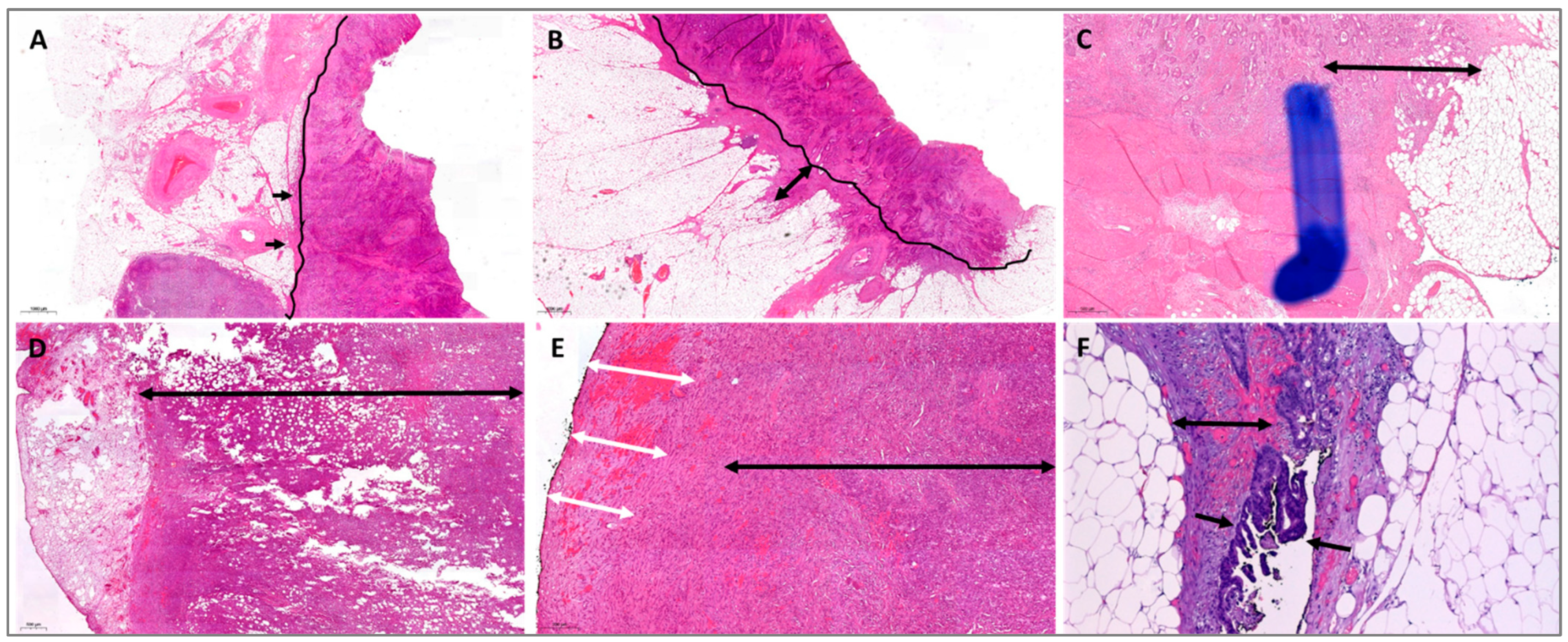 Cancers 14 06186 g001