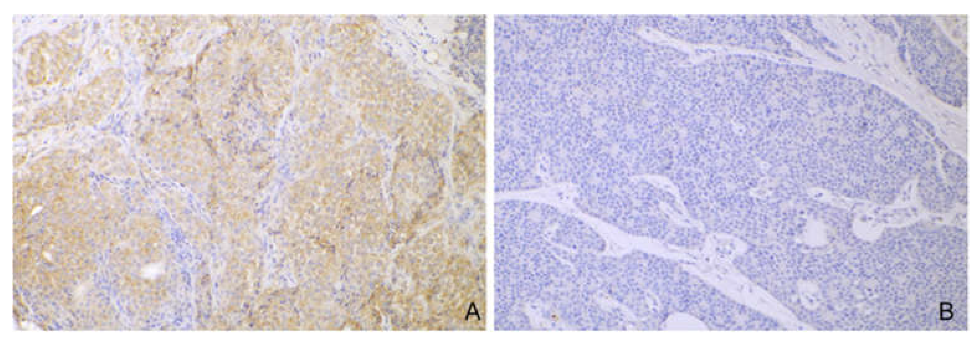 Cancers 14 06188 g002