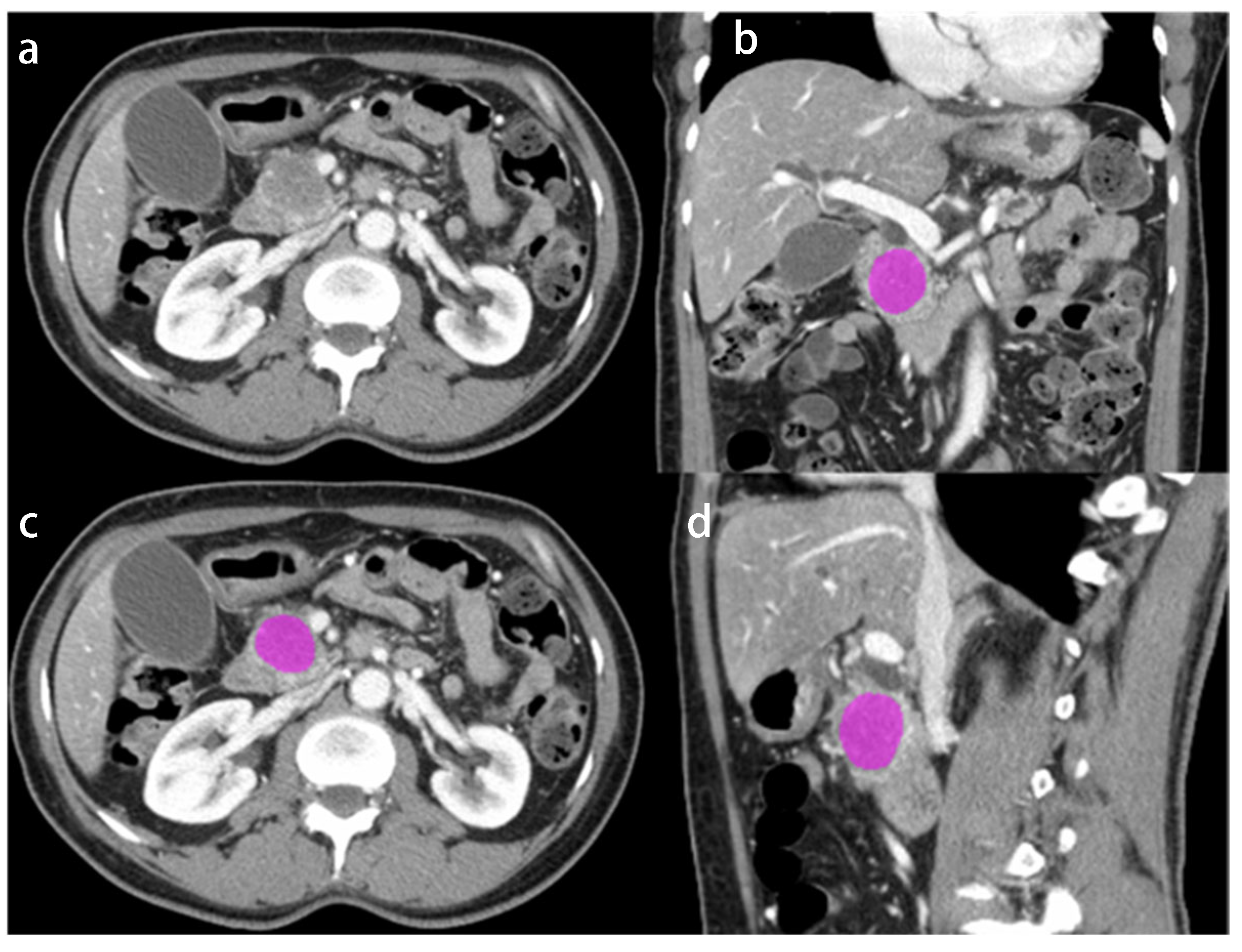 Cancers 14 06224 g001