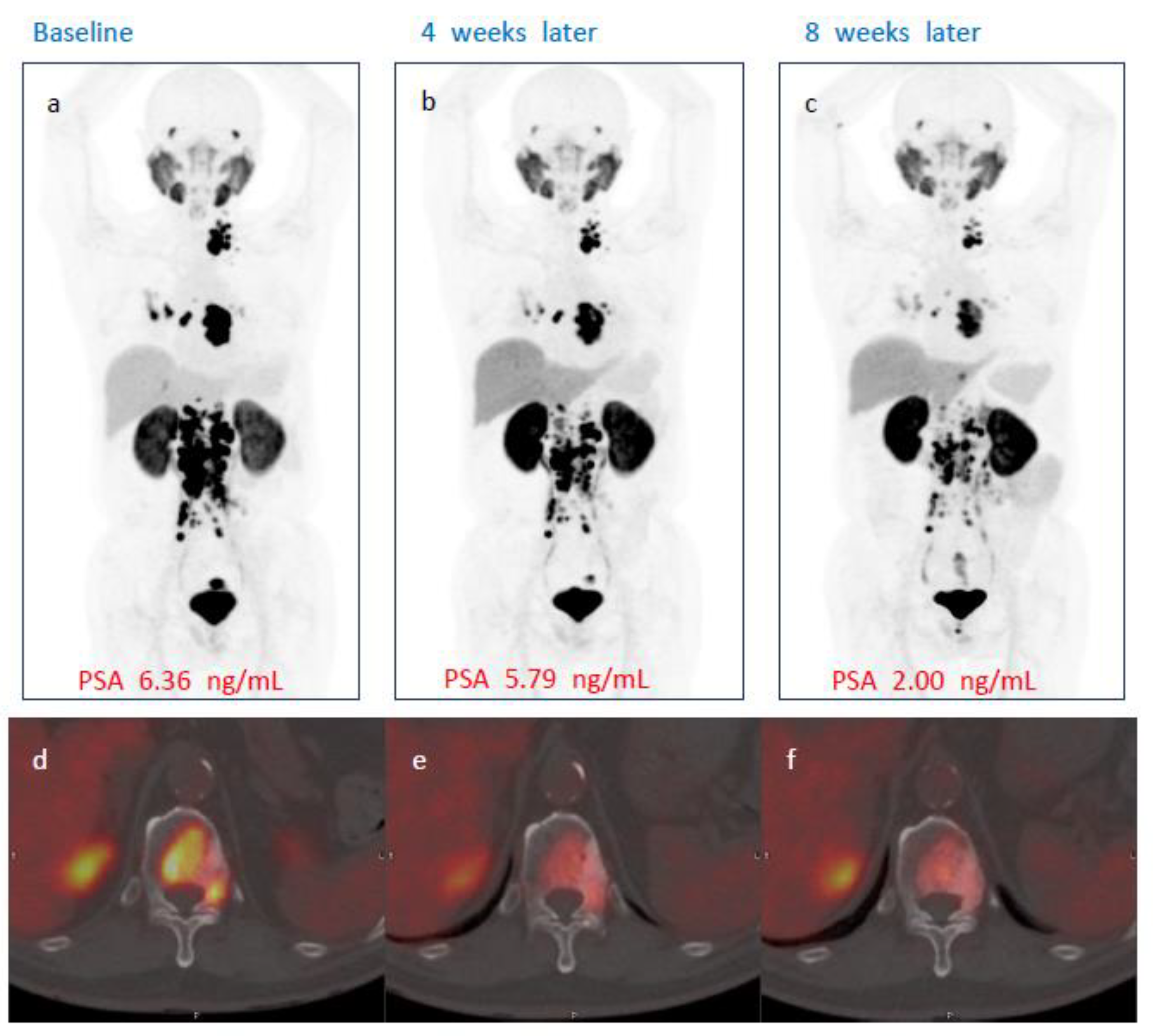 Cancers 14 06225 g003 Cancers 14 06225 g003