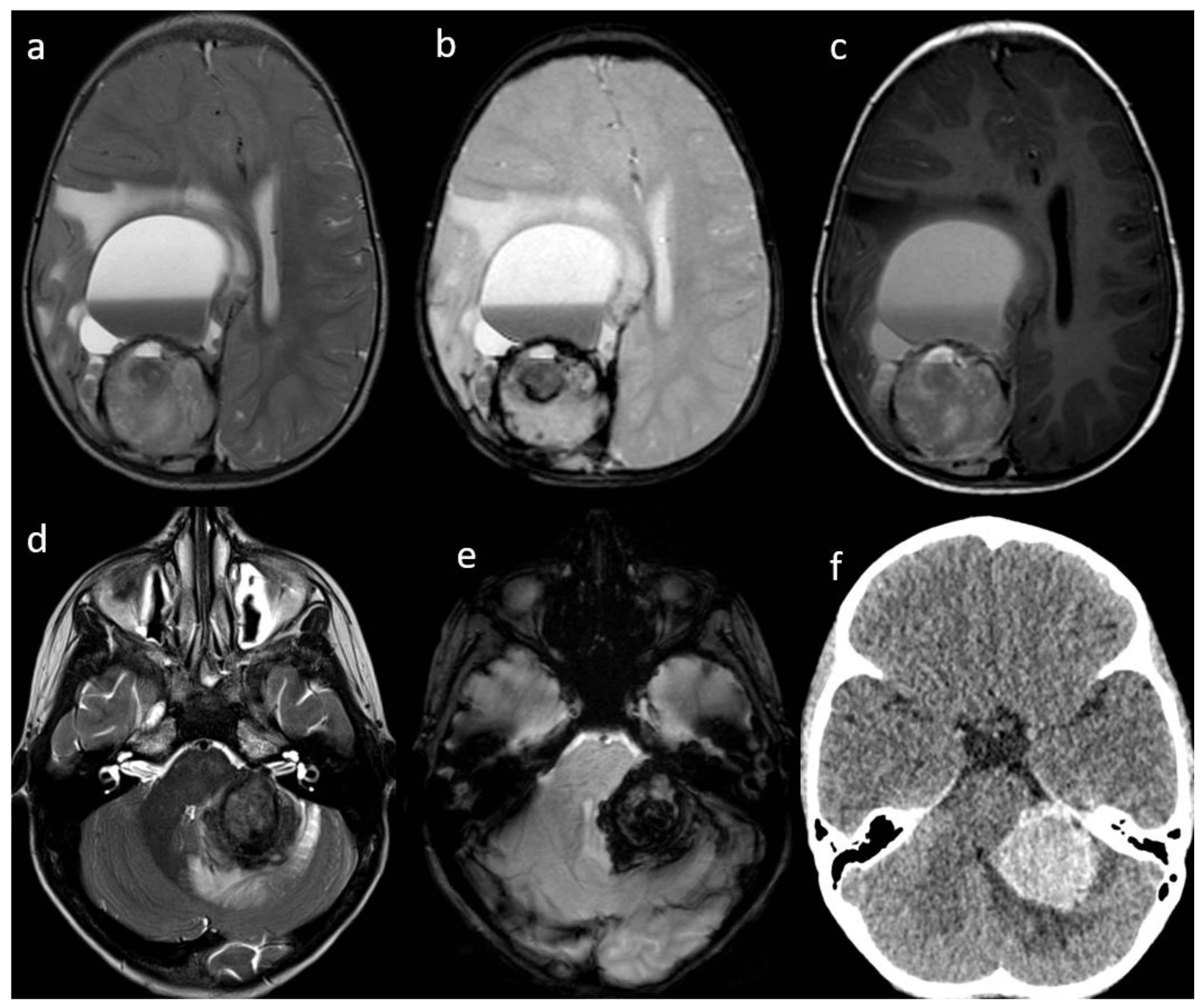 Cancers 14 06249 g001