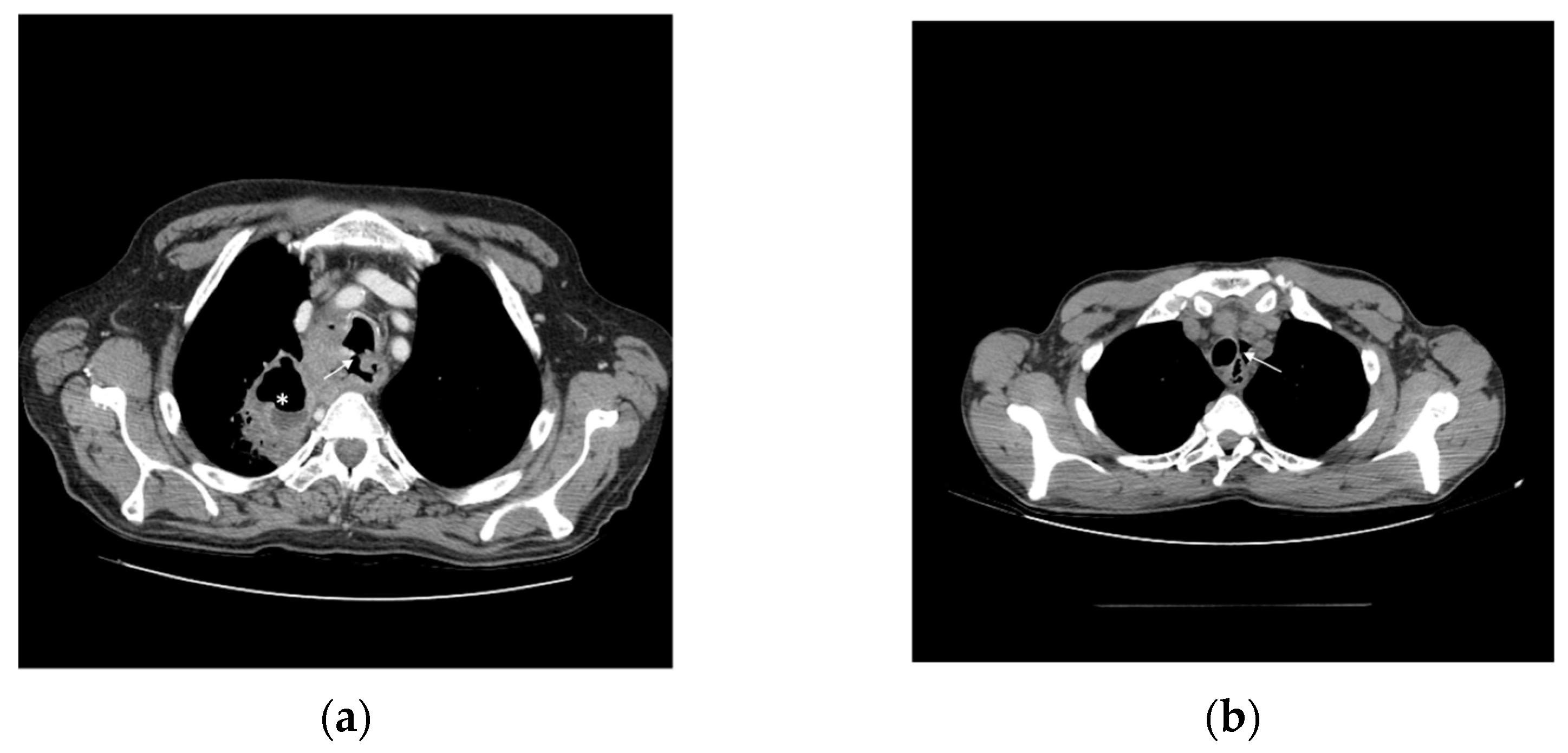 Cancers 14 06268 g002