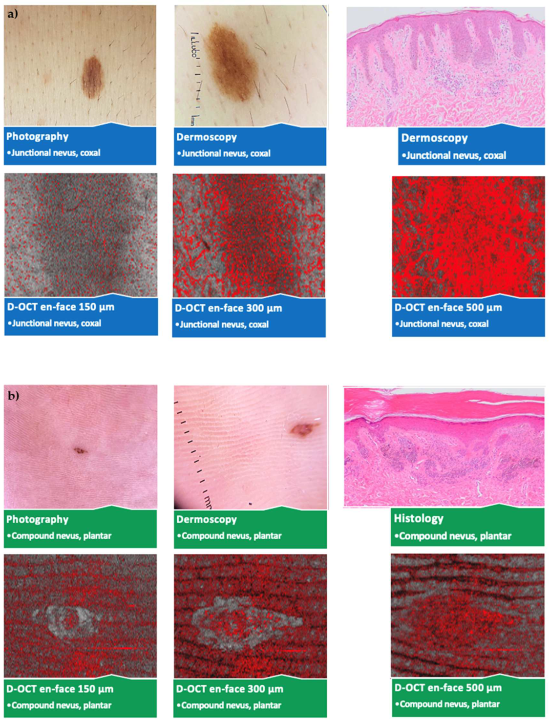 Cancers 15 00020 g004a