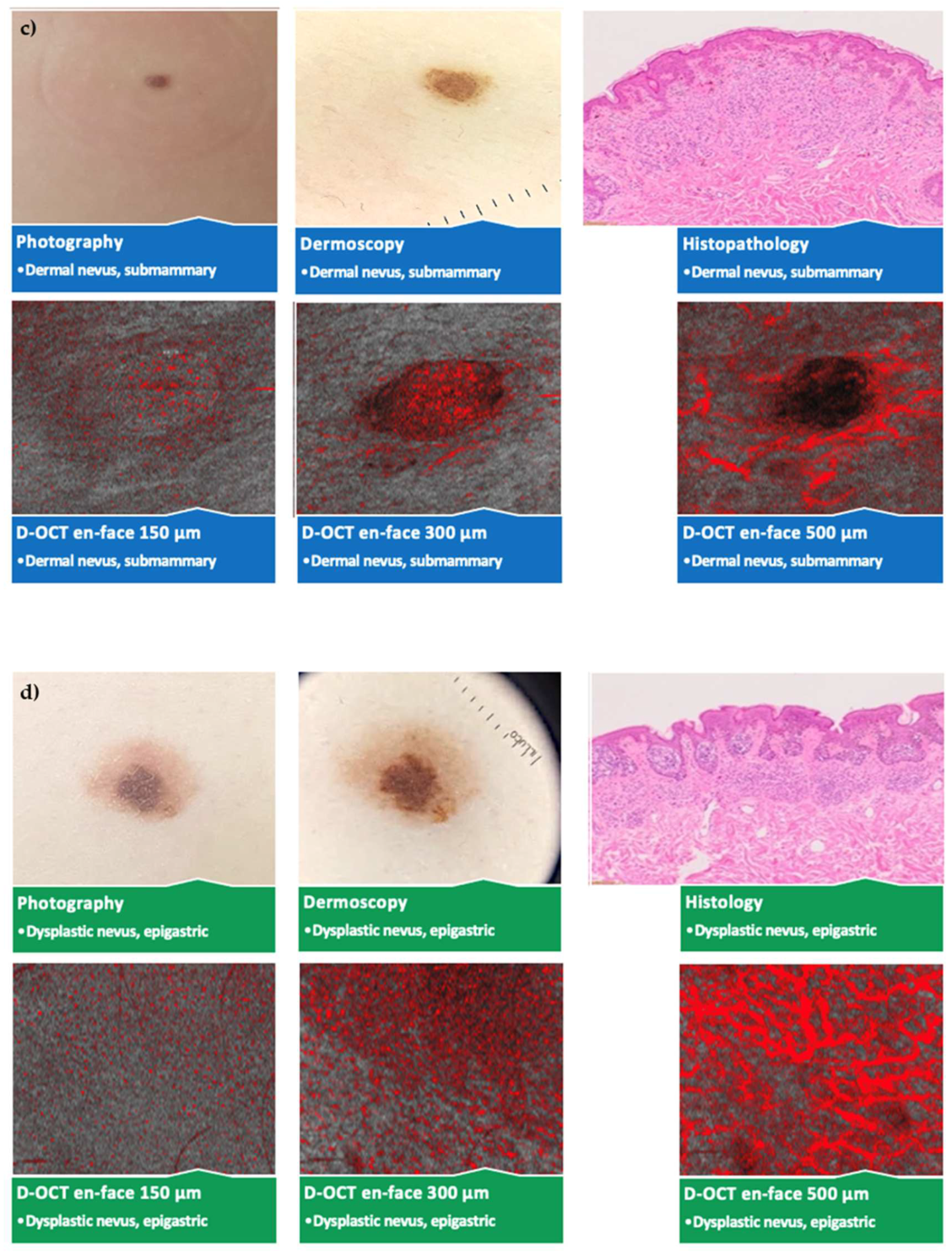 Cancers 15 00020 g004b