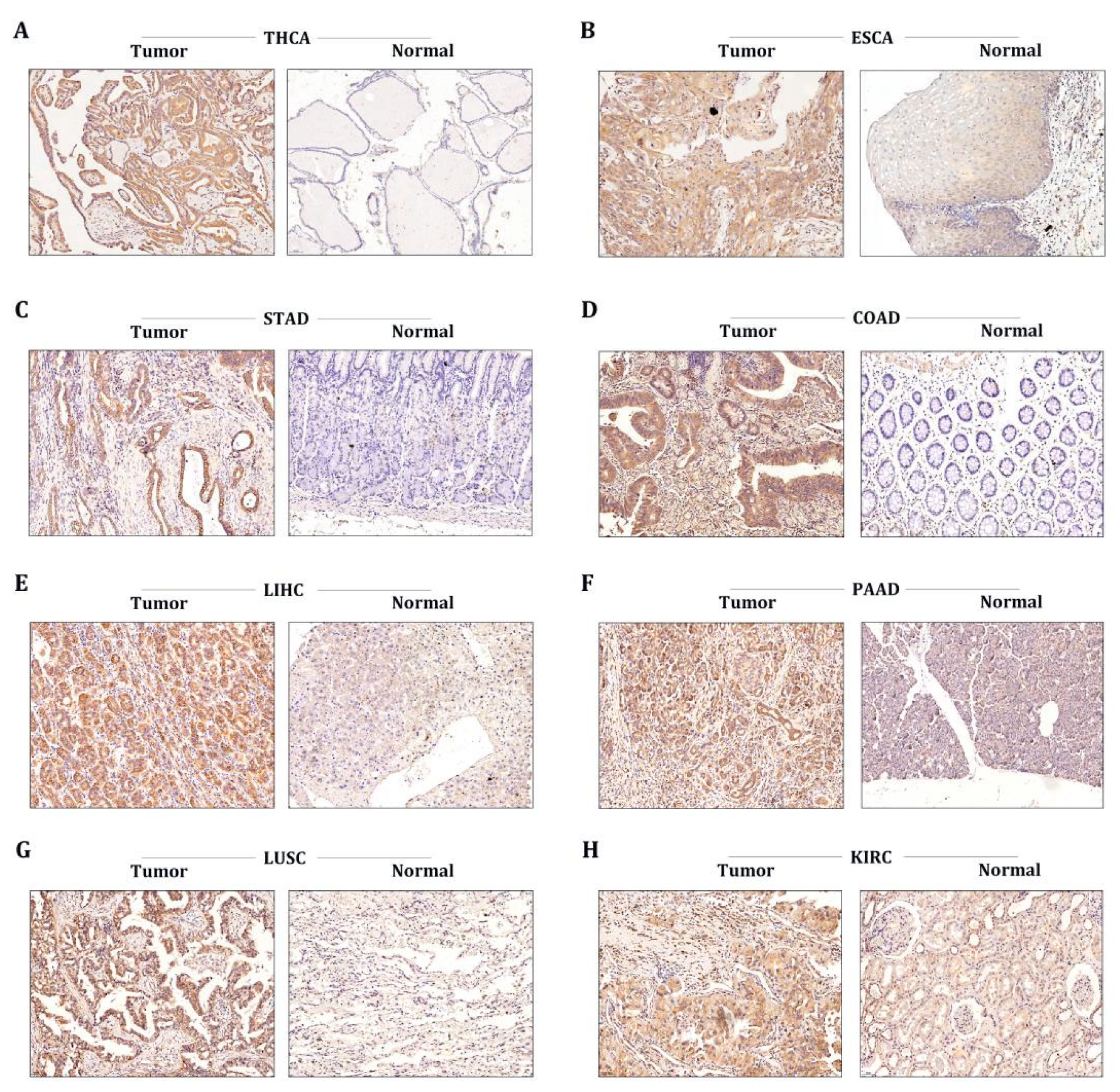 Cancers 15 00027 g006