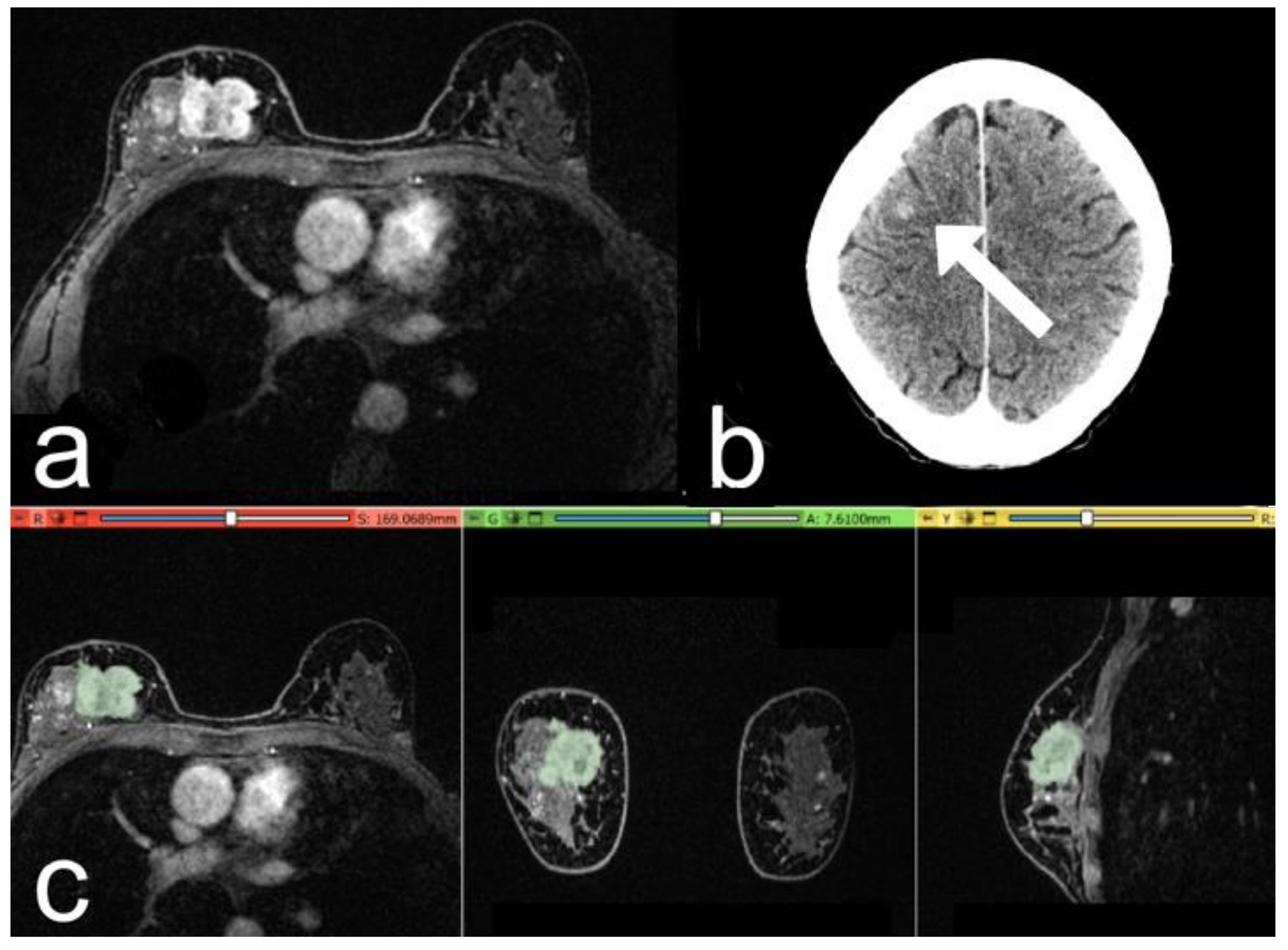 Cancers 15 00036 g004