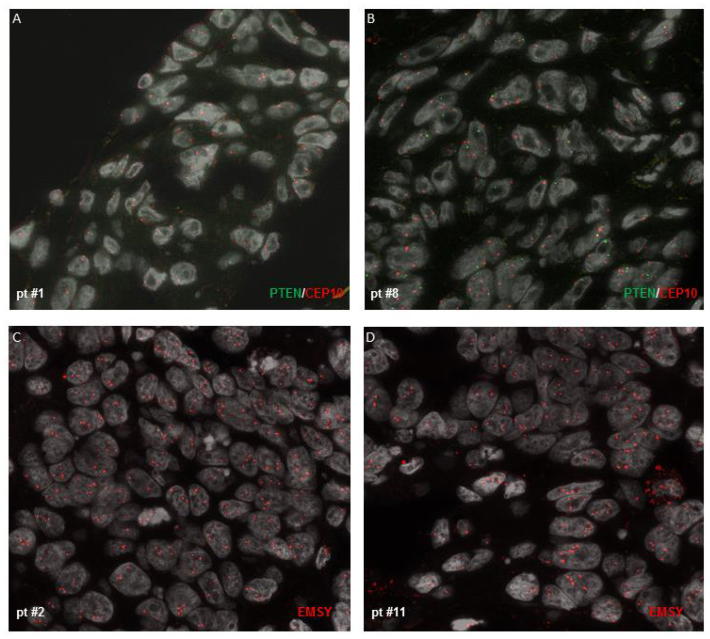 Cancers 15 00043 g002