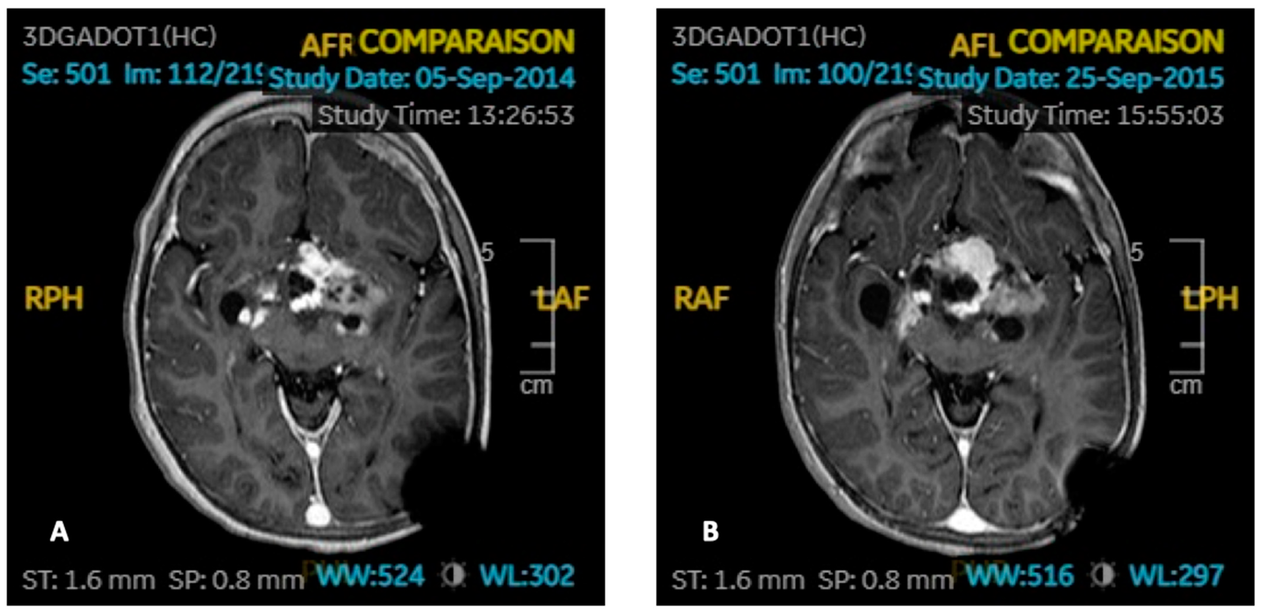 Cancers 15 00055 g003