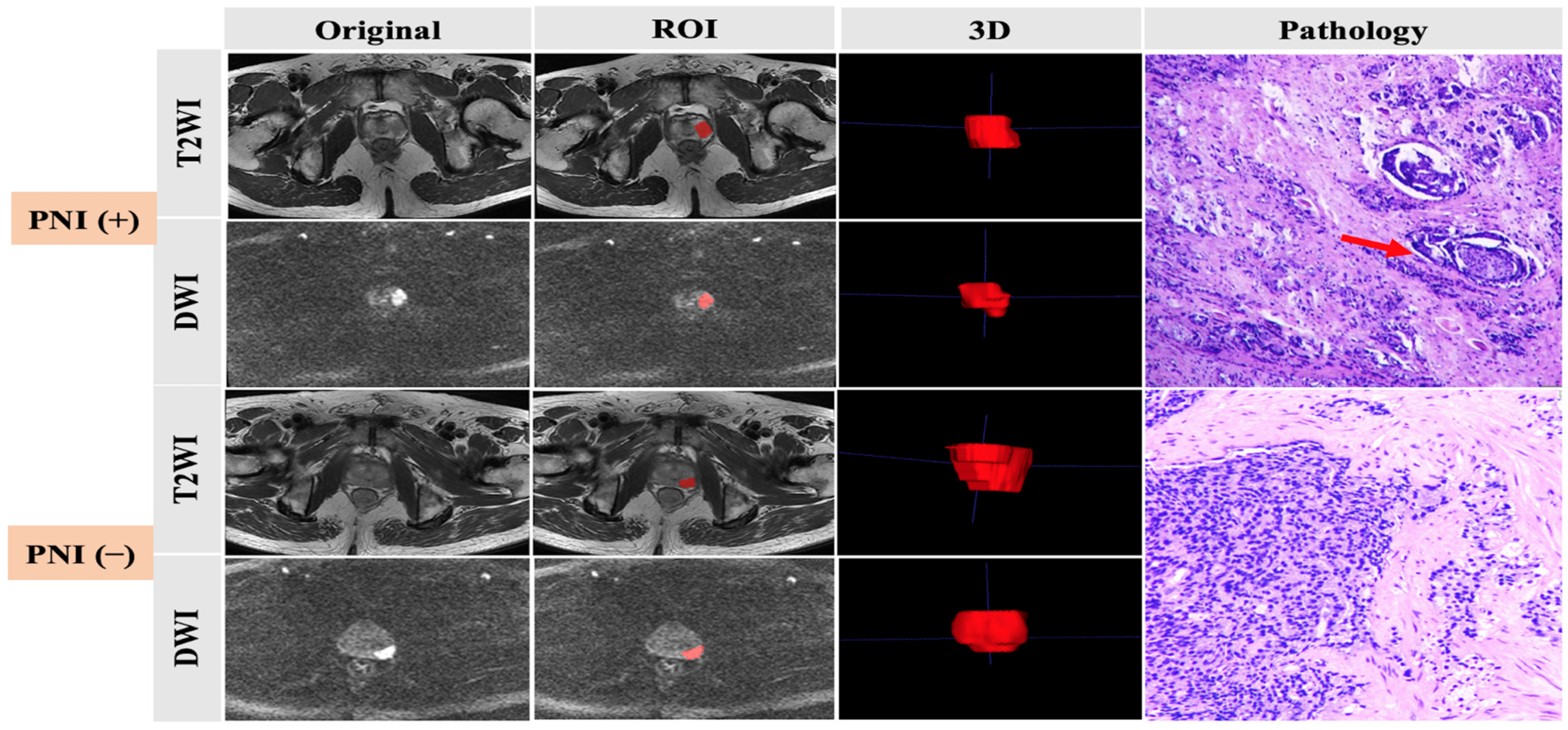 Cancers 15 00086 g001 Cancers 15 00086 g001