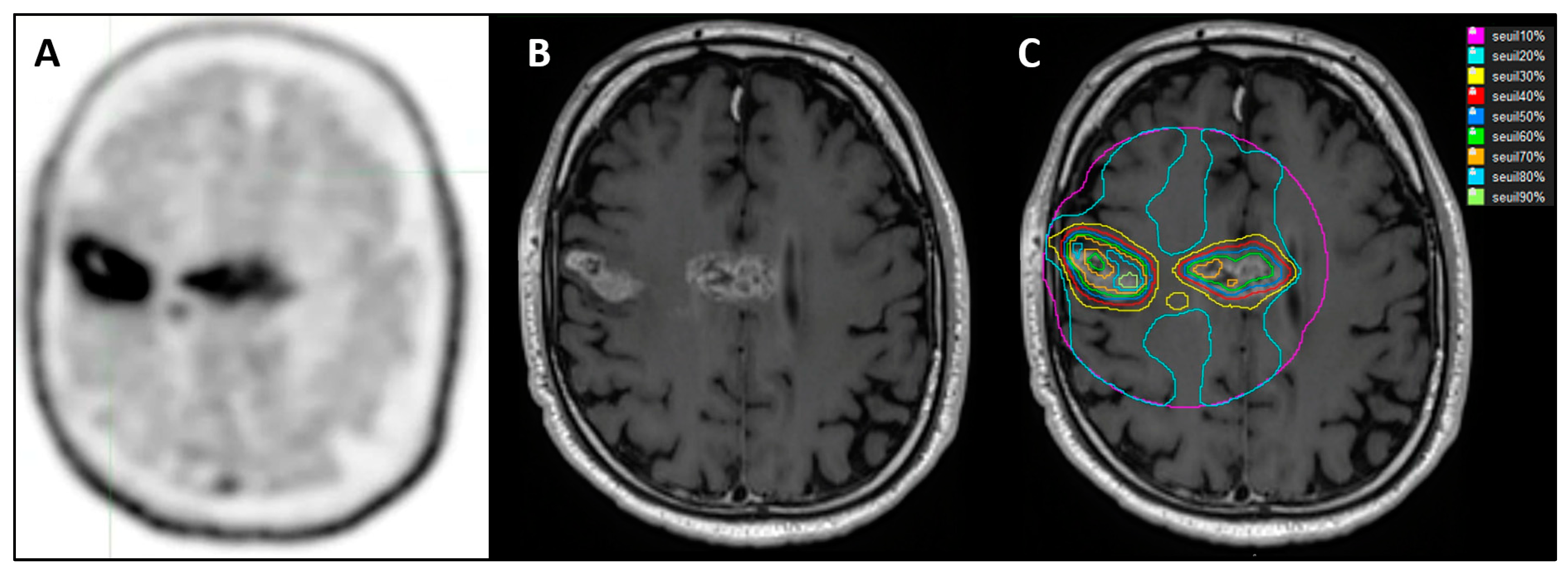 Cancers 15 00098 g003 Cancers 15 00098 g003