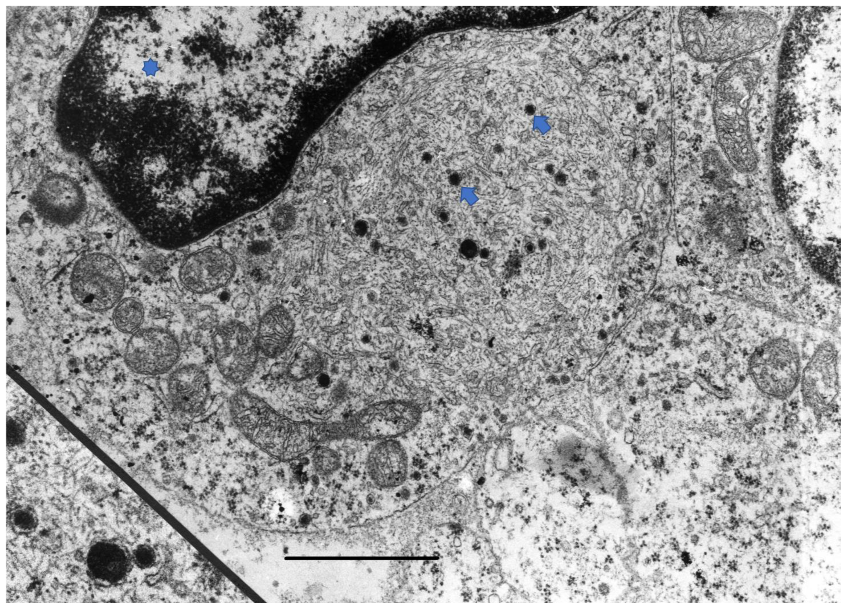 Cancers 15 00103 g003