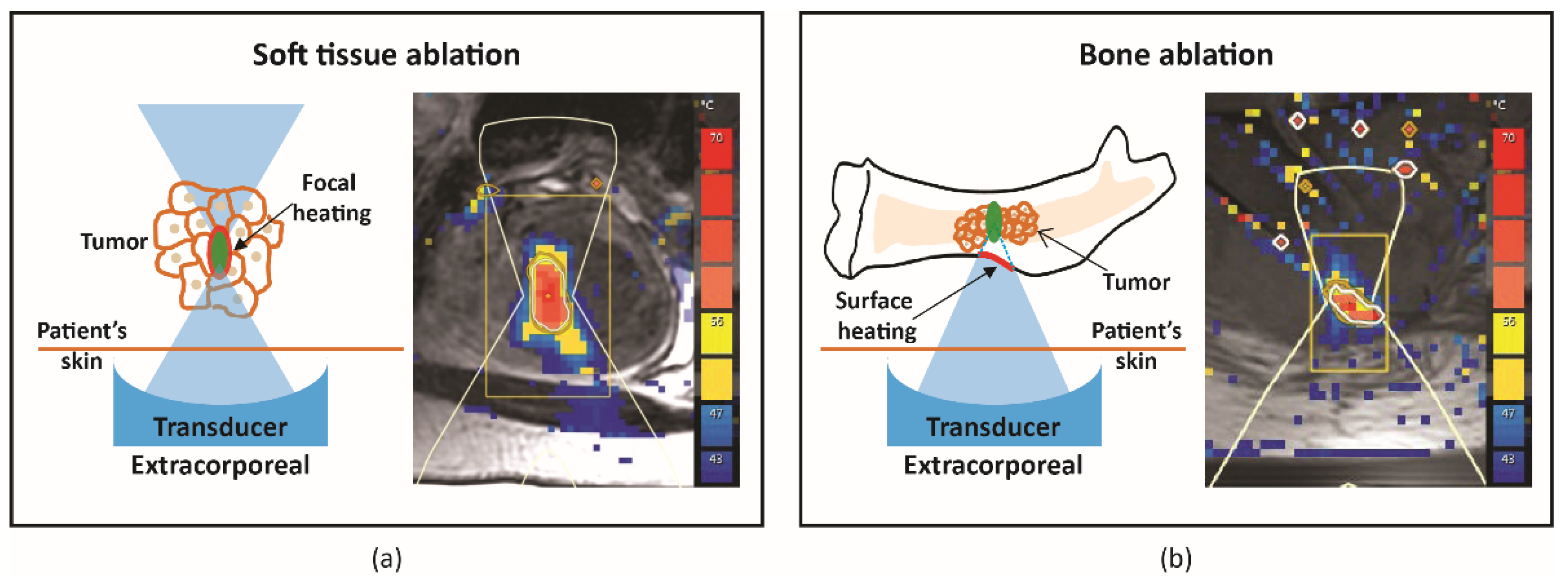 Cancers 15 00108 g001 Cancers 15 00108 g001