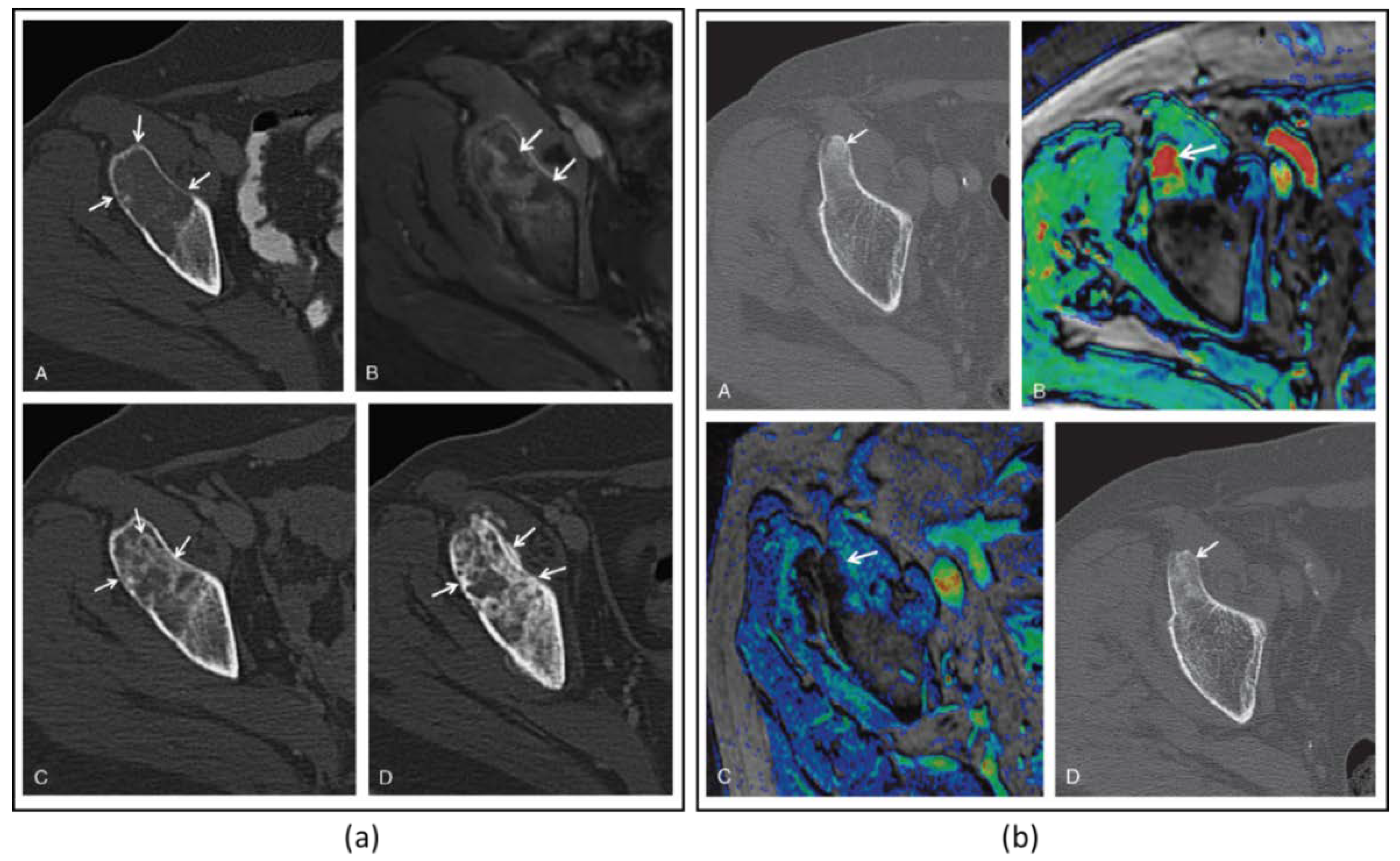Cancers 15 00108 g004 Cancers 15 00108 g004