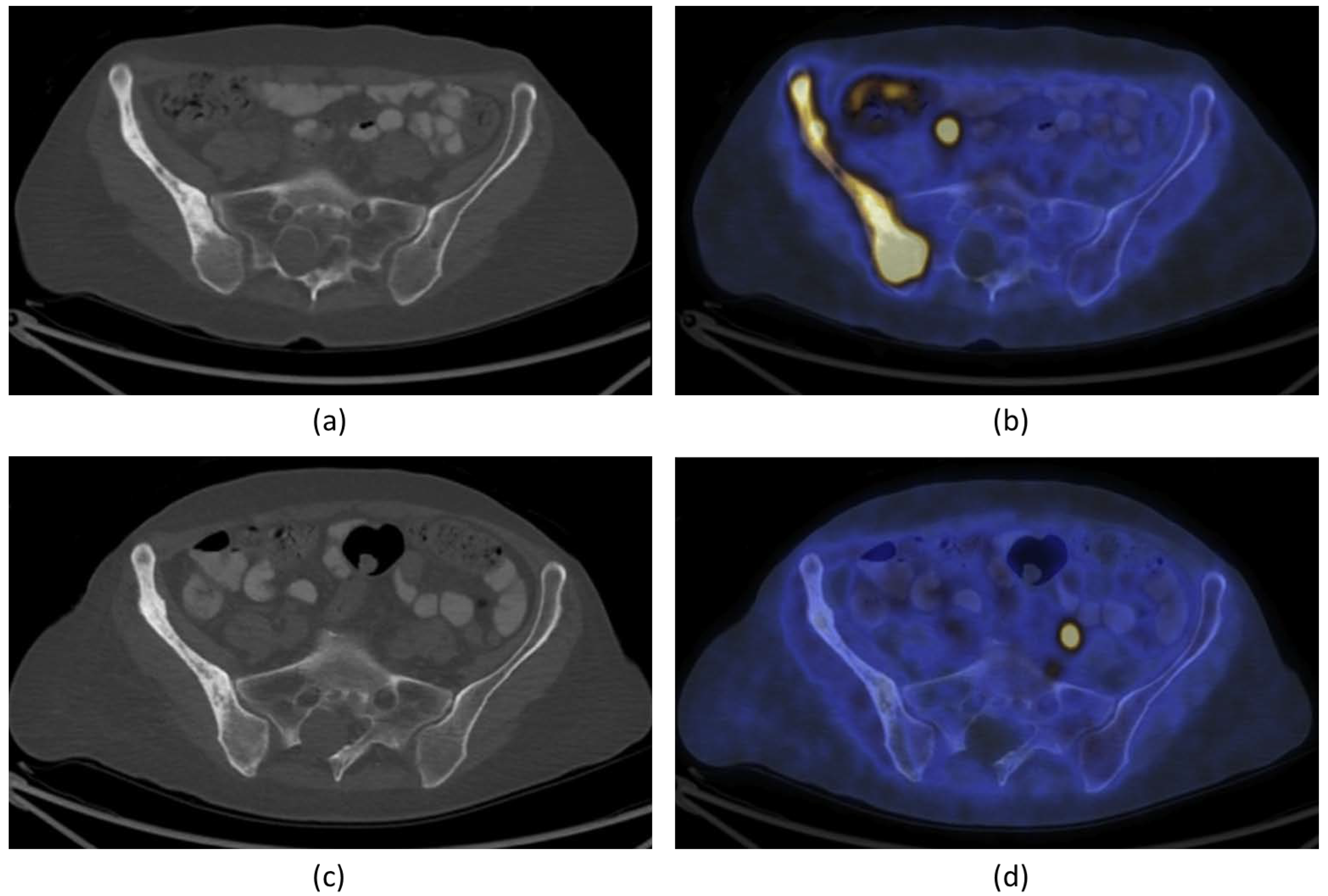 Cancers 15 00108 g005 Cancers 15 00108 g005