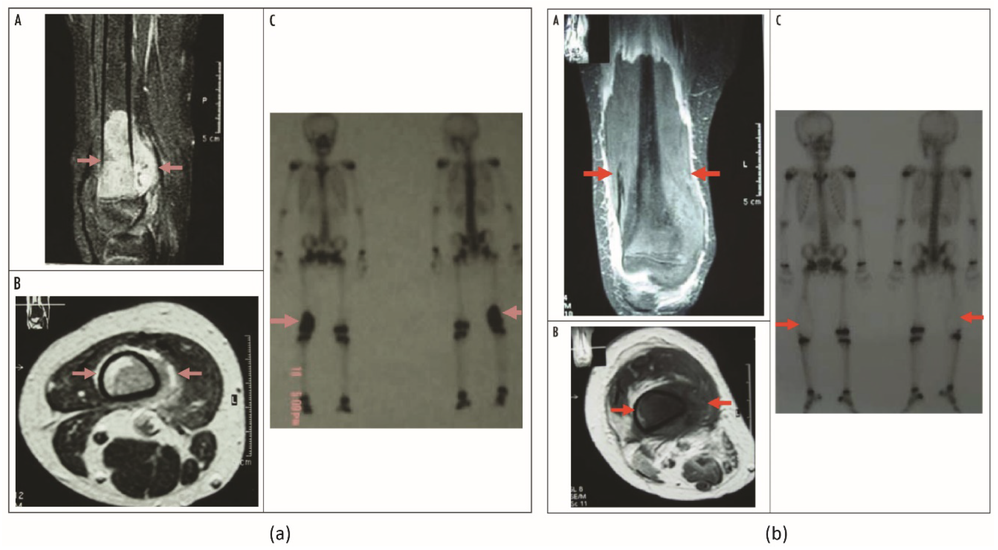Cancers 15 00108 g006 Cancers 15 00108 g006